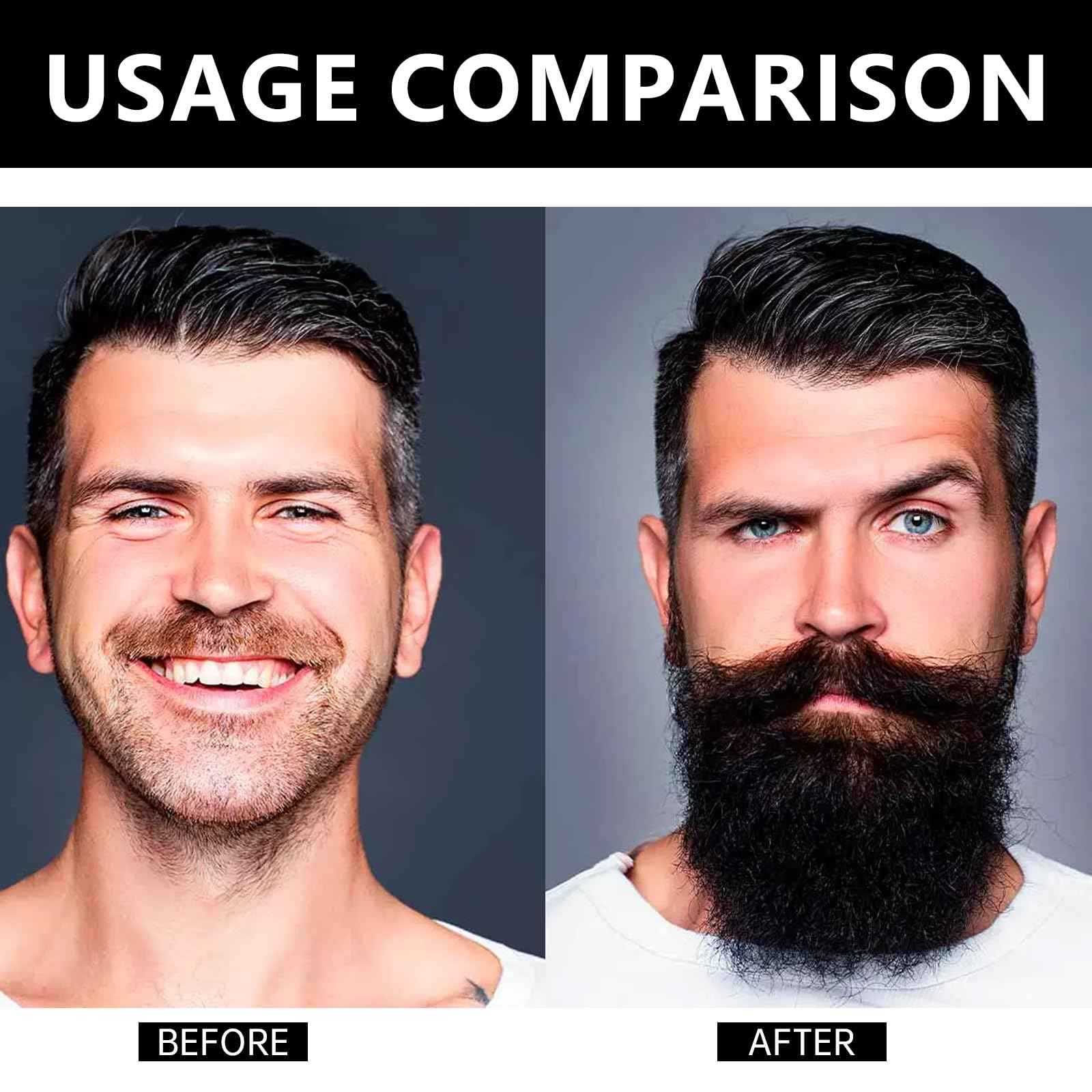 Estimulante Para Barba – Bálsamo de Crecimiento Ultra Potente, Barba Crema, Beard Growth Balm, Moisturizes & Strengthens Beard, 100 ml / 3.5 oz(3PC)