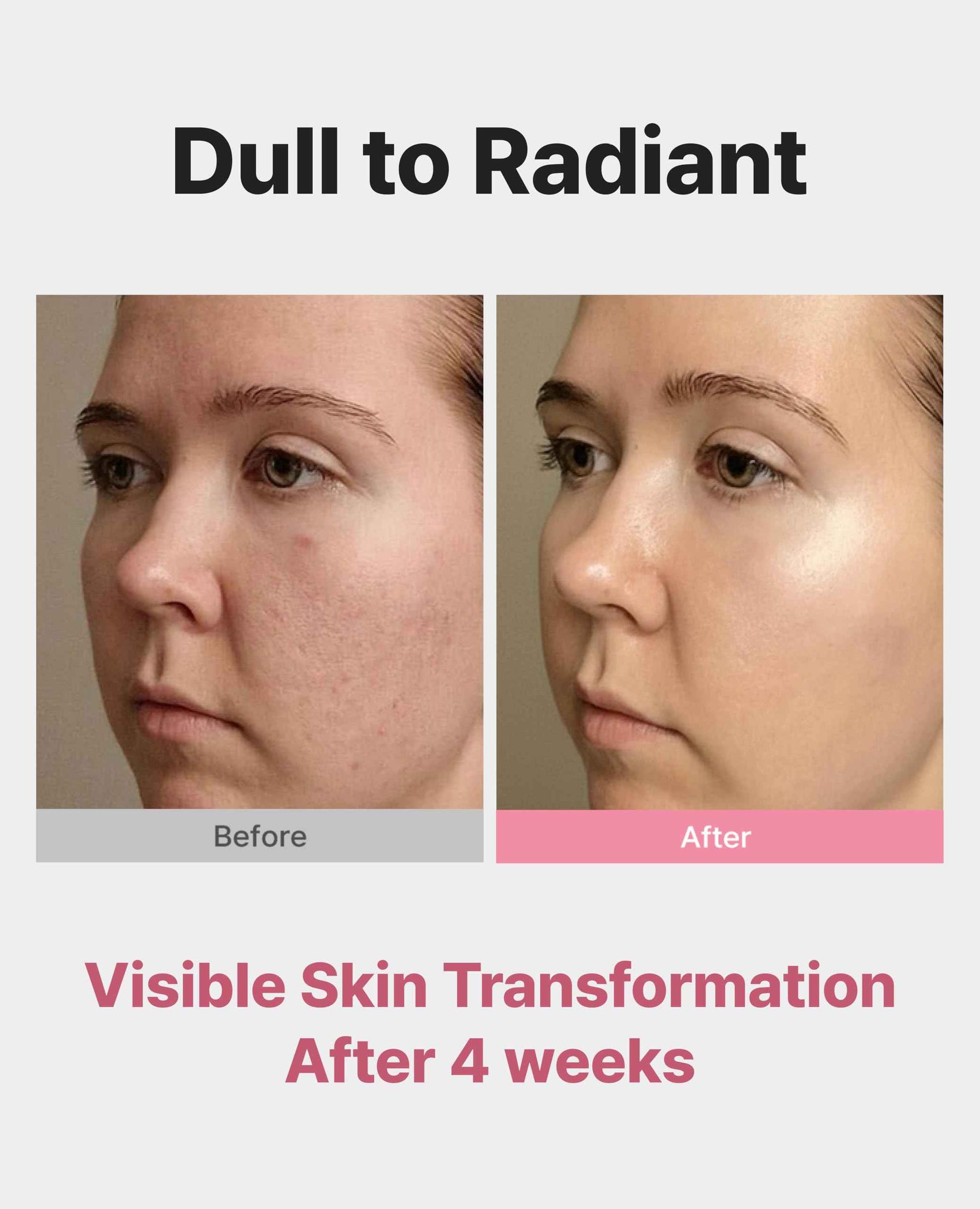 Delere Caviar AHA 3% Glow Toner | Korean Collagen Exfoliating Toner | Korean Exfoliator for Radiance, Collagen Skin Care, 250ml