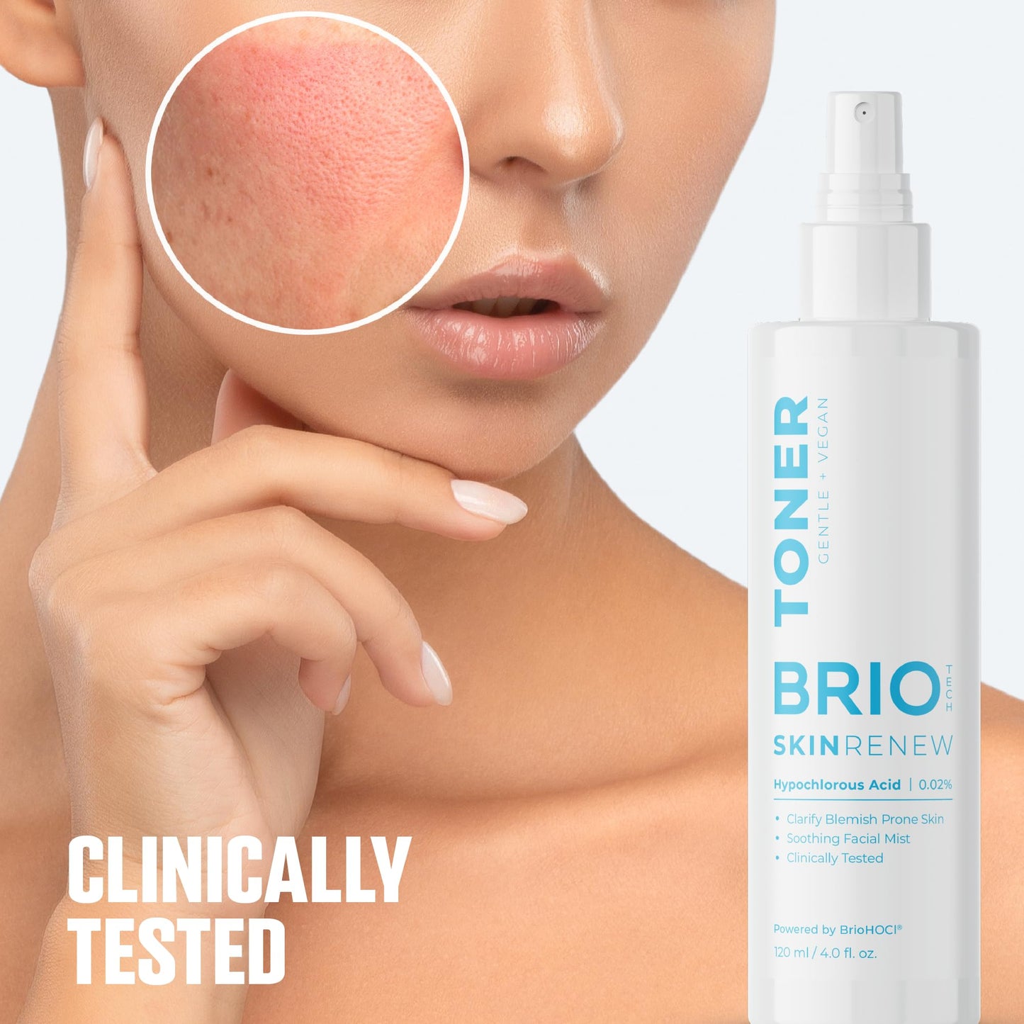 BRIOTECH Skin Renew Toner, Hypochlorous Acid Spray Topical Skin Spray for Face and Skin, Minimize Appearance of Blemishes, Soothing Mist for Redness & Bumps, 4 fl oz