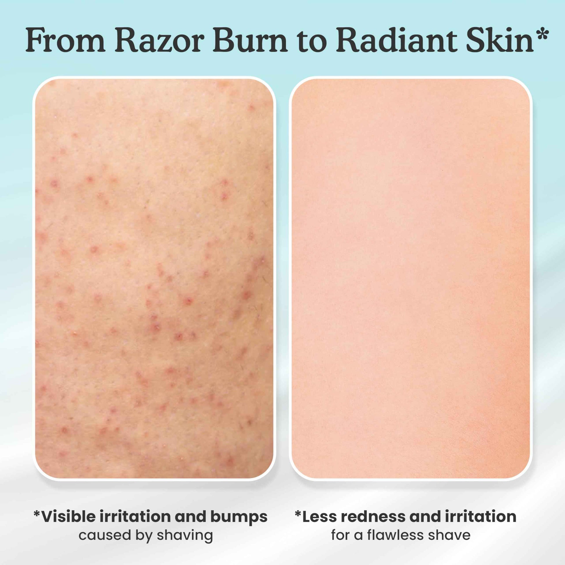 Shaveworks Pearl Soufflé Shaving Cream for Women – Soothing, Hydrating Shave Lotion for Legs, Underarms, Bikini Area – Reduces Irritation, Slows Future Hair Growth 5.3 Fl Oz