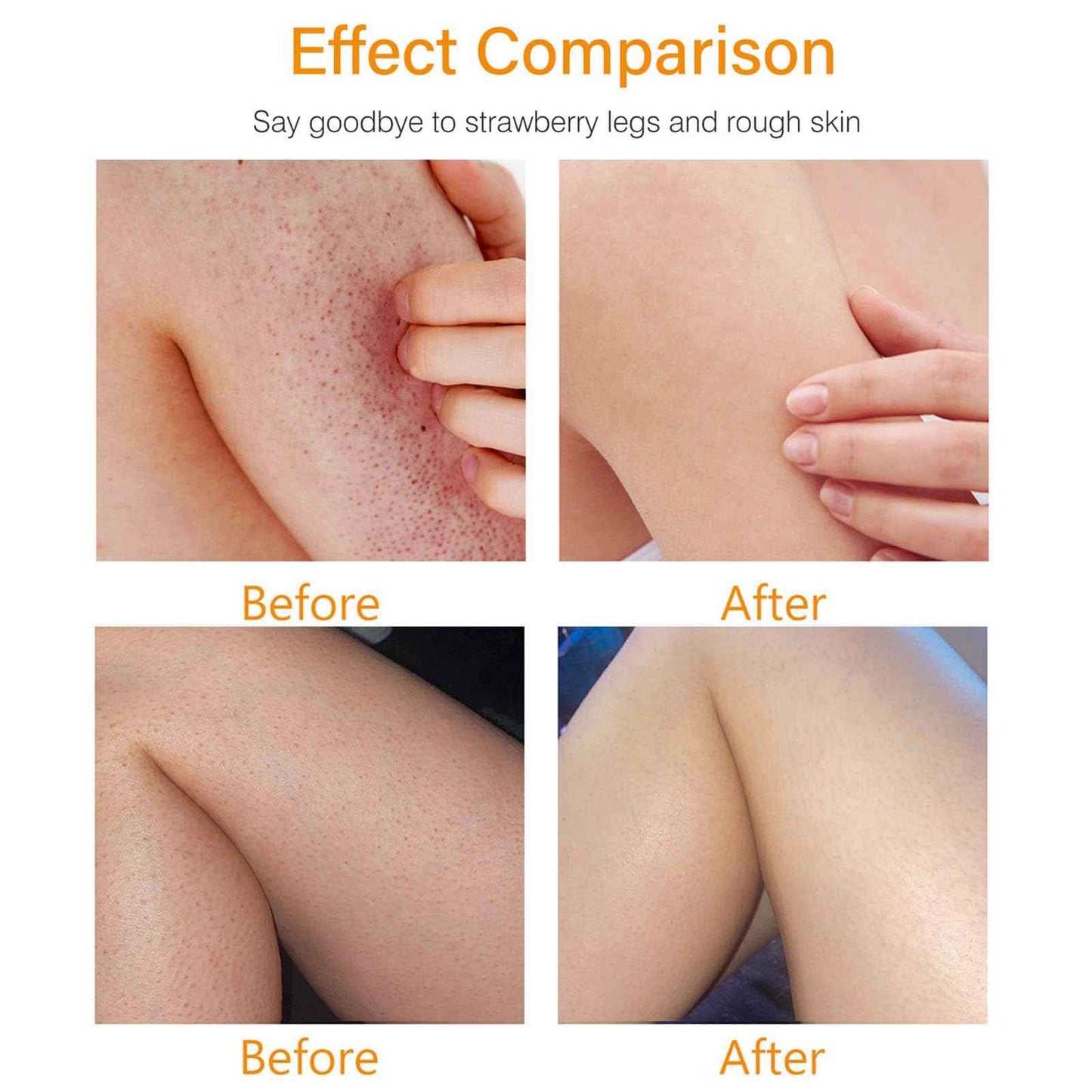 Strawberry Skin Treatment– Strawberry Legs Resurfacing Cream, Ultra Strength Exfoliating Body Lotion for Rough & Bumpy Skin, Body Care moisturizer for Women (2)