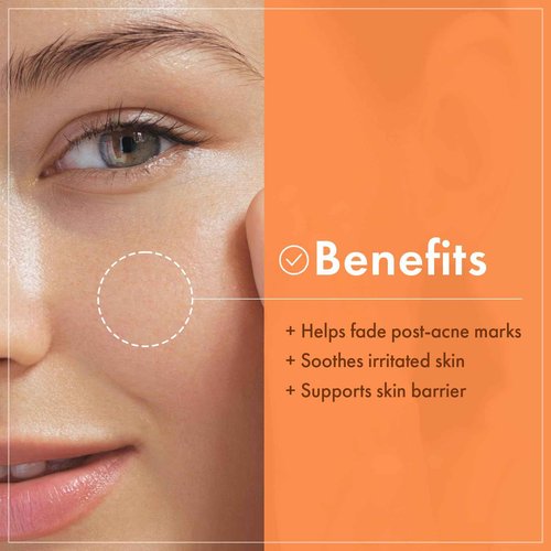 NATUREKIND Niacinamide Vitamin Ampoule - 20,000ppm Vitamin B3 Concentrated Serum, Panthenol, Hydrating, Fine Lines, Post Acne Marks, Uneven Skin Tone & Dull Skin, Korean Skin Care, 100ml, 3.38 fl.oz.