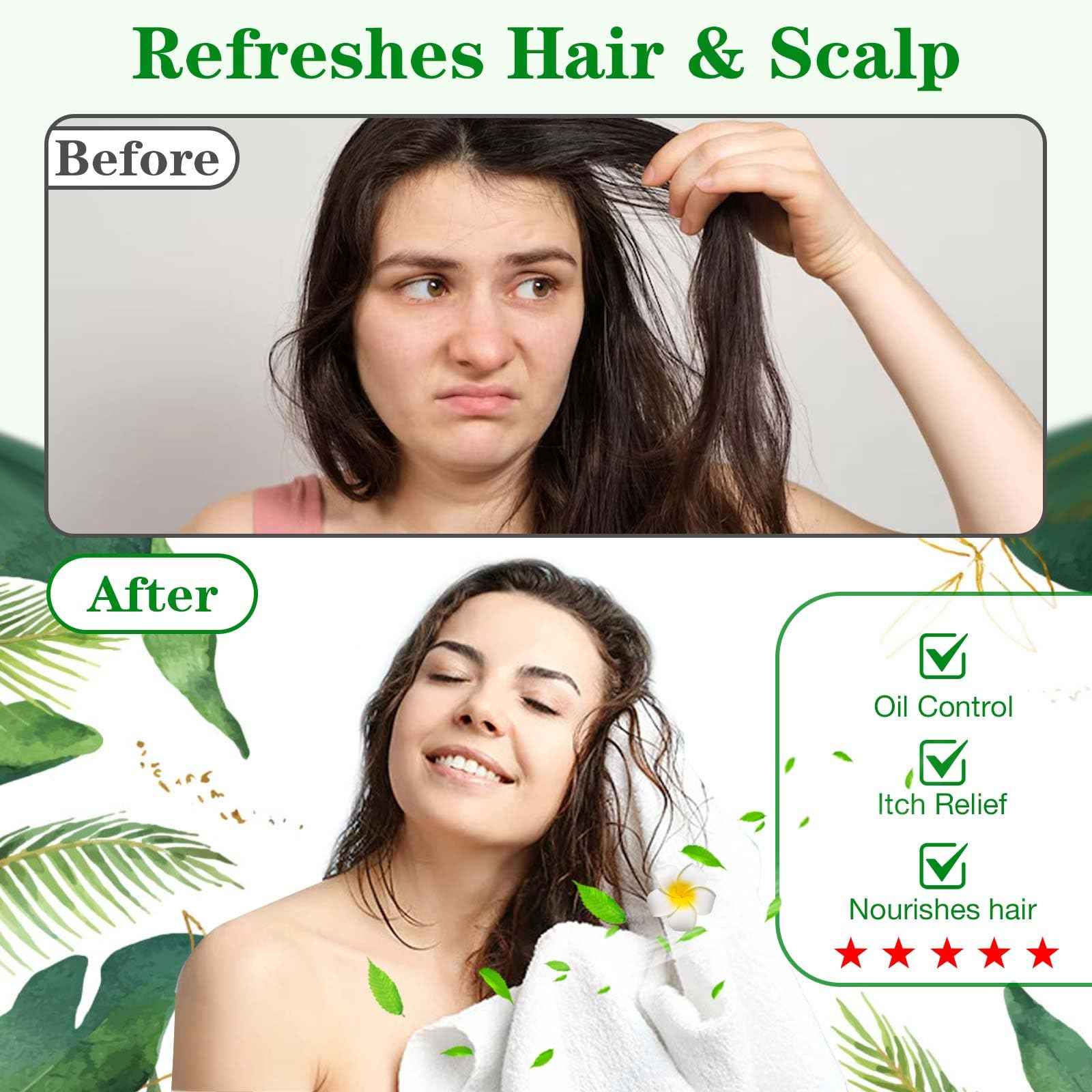 Shampoo Caps No Rinse, 12 Pack Waterless Shampoo Caps for Bedridden Patients and Elderly, Rinse Free Hair Washing Shower Caps for Post Surgery, Hospital, Camping