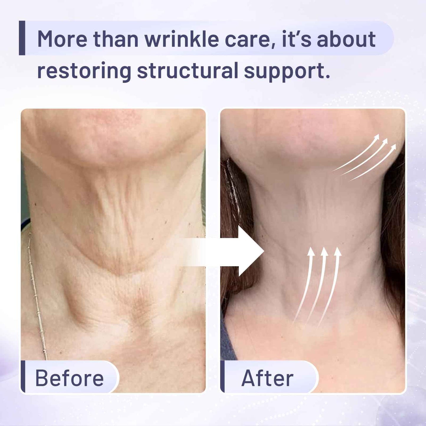 ZZILME Premium Neck Firming Cream – Lifting & Tightening Treatment for Décolleté and Chest, Anti-Aging Neck Cream Reduces Fine Lines and Sagging, Gift for Women & Men, 2.03 Fl Oz