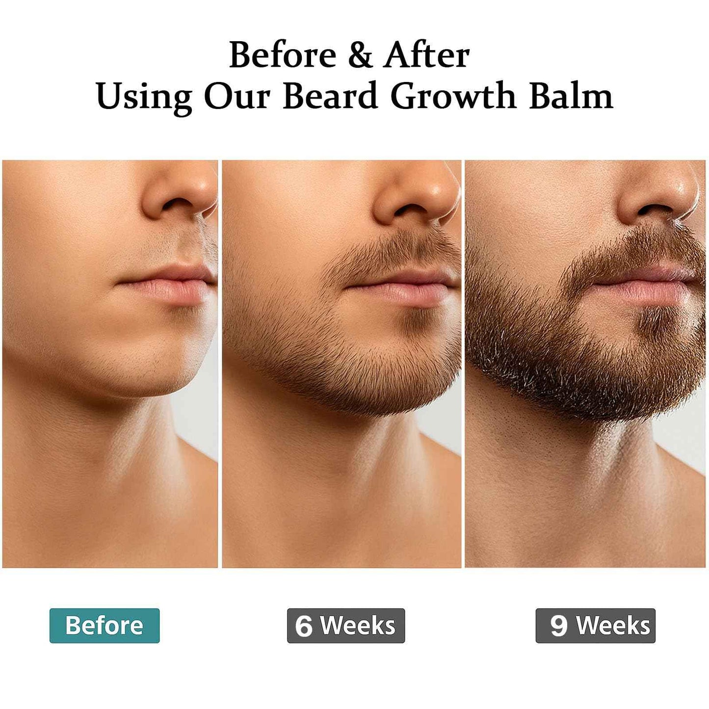 Estimulante Para Barba – Bálsamo de Crecimiento Ultra Potente, Beard Stimulating Balm, Moisturizes & Strengthens Beard, 100 ml / 3.5 oz