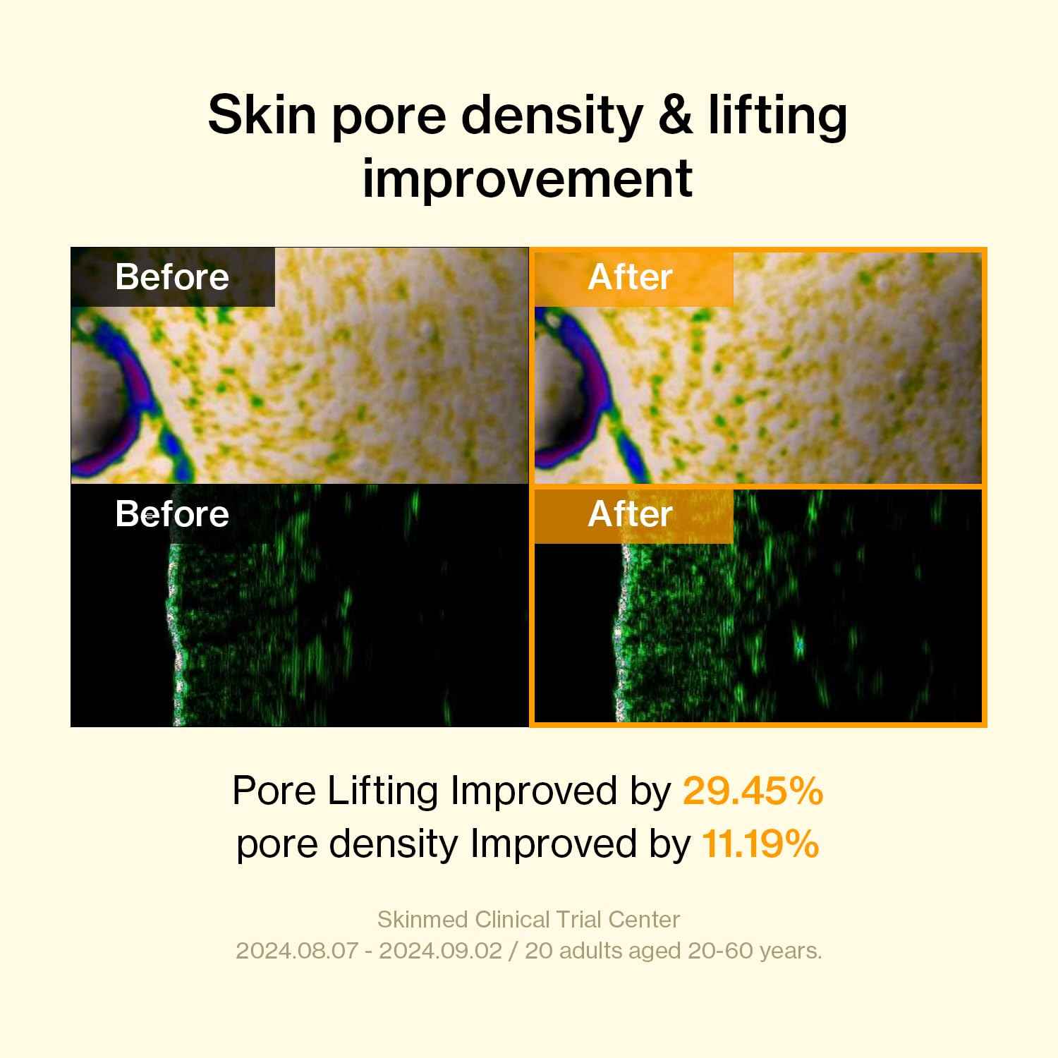 Banatinol Slow aging Ampoule 30 ml Korean Skincare Retinol Serum For Face 1.01 Fl Oz