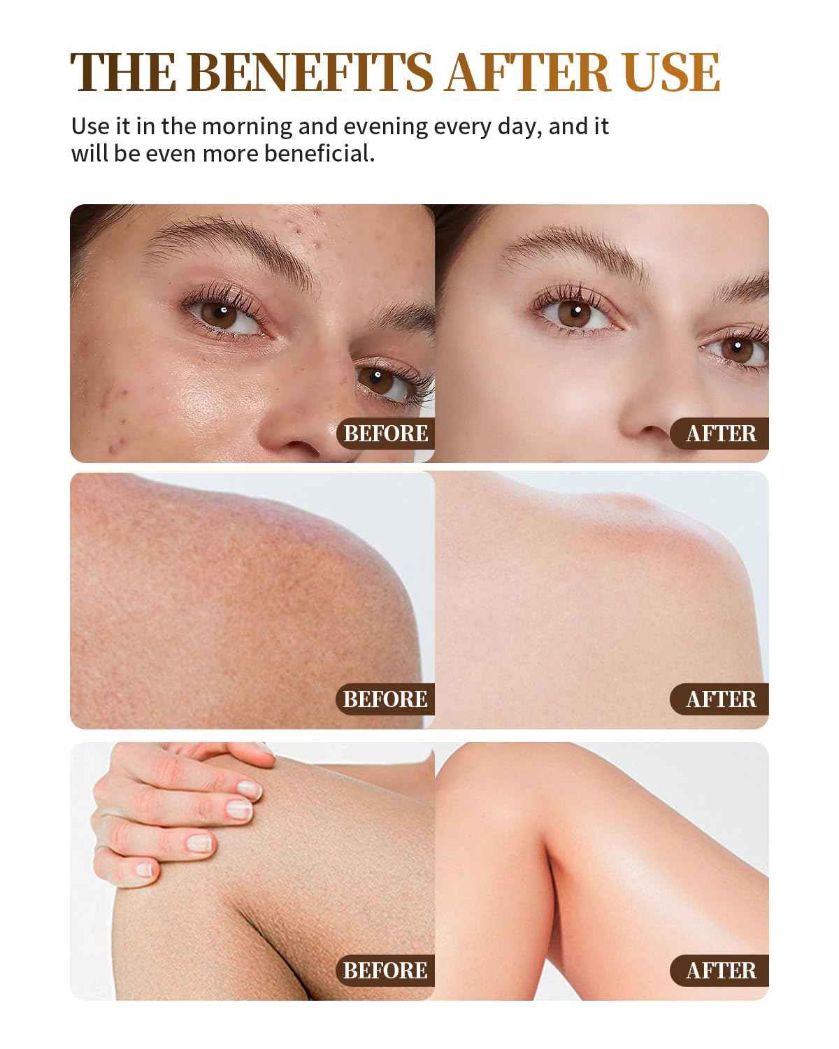 Upgraded Beef Tallow for Skin Handmade Whipped Organic Grass-Fed Tallow Balm with Raw Wild Honey for Eczema & Rosacea,Non-Comedogenic Face,Body Moisturizer for Dry, Sensitive Skin - 4oz Unscented