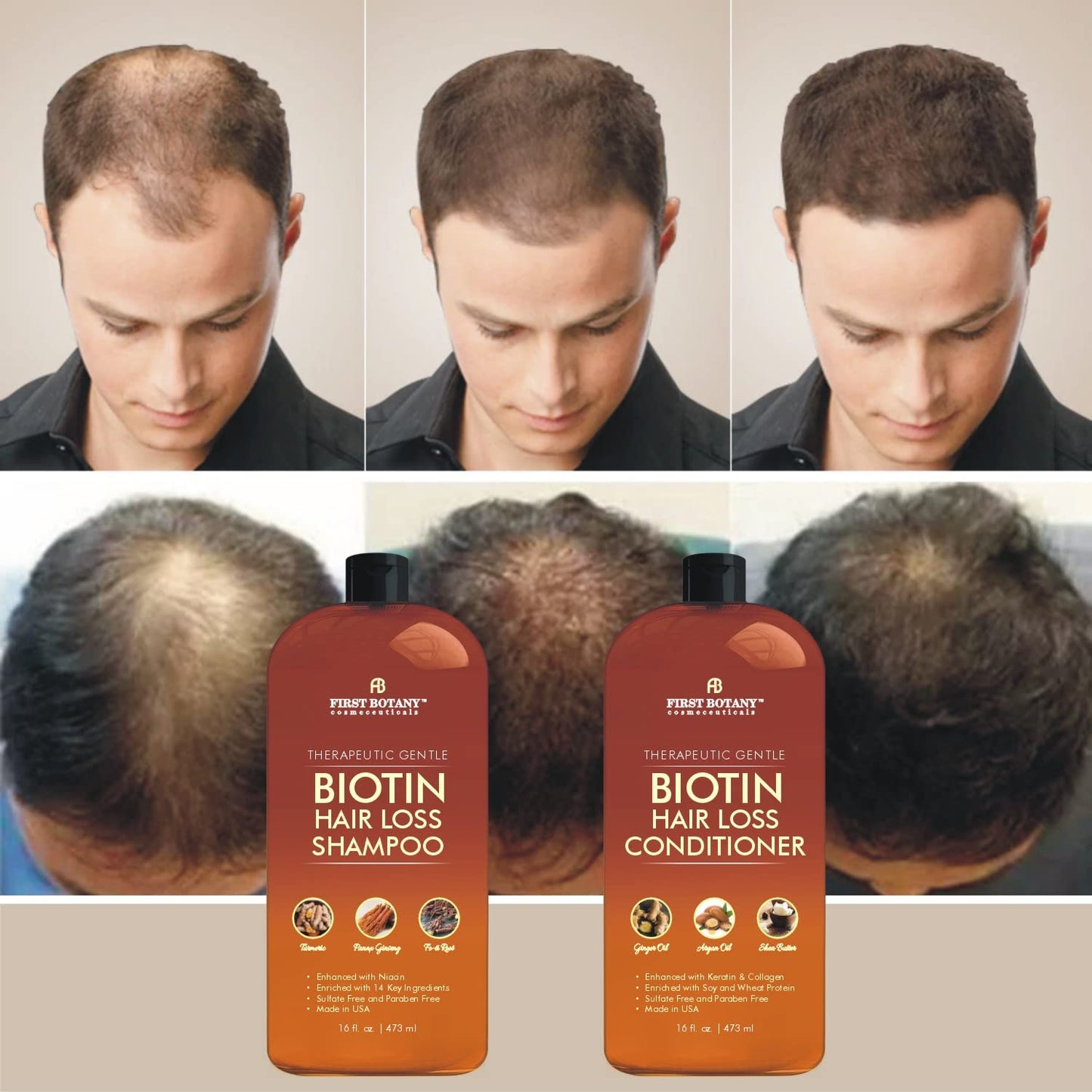 First Botany, Hair Growth Shampoo Conditioner Set - An Anti Hair Loss Biotin Shampoo & Conditioner with DHT blockers to fight Hair Loss For Men & Women, All Hair types, Sulfate Free - 2 x 16 fl oz