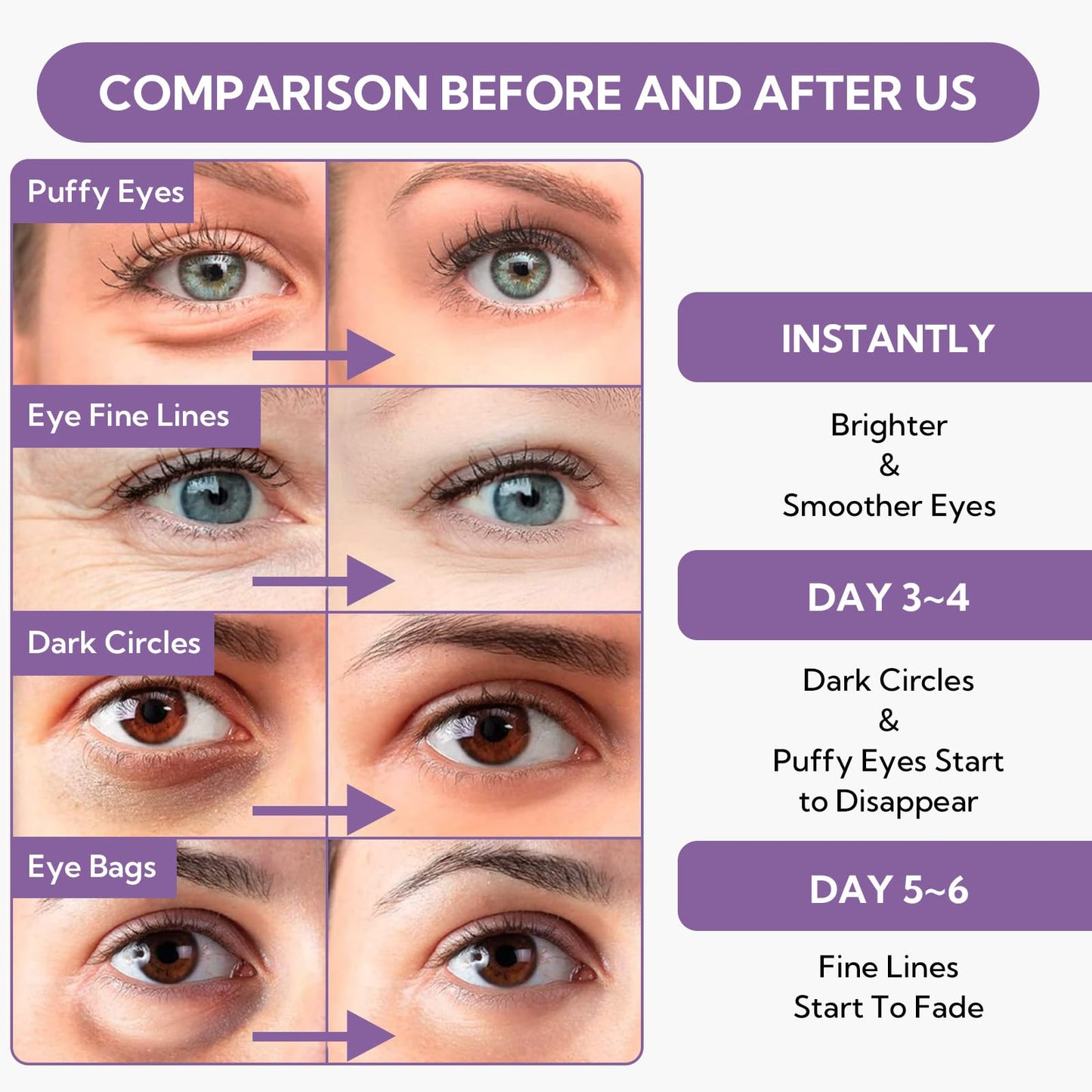 Retinol Under Eye Patches(30 Pairs) -Cooling Eye Masks for Rejuvenating,with Caffeine Niacinamide Tetrapeptide Hydra-Gel Collagen, Puffy Eyes & Dark Circles Treatment, Fine Lines & Wrinkles Reduce