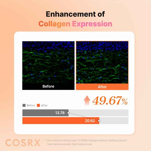 COSRX 5 PDRN Collagen Intense Vitalizing Serum - Korean Serum for Skin Firming & Glowing with Salmon DNA, Centella, Lactobacillus PDRN & Collagen, Korean Skin Care, Stocking Stuffers (3.38 fl.oz.)