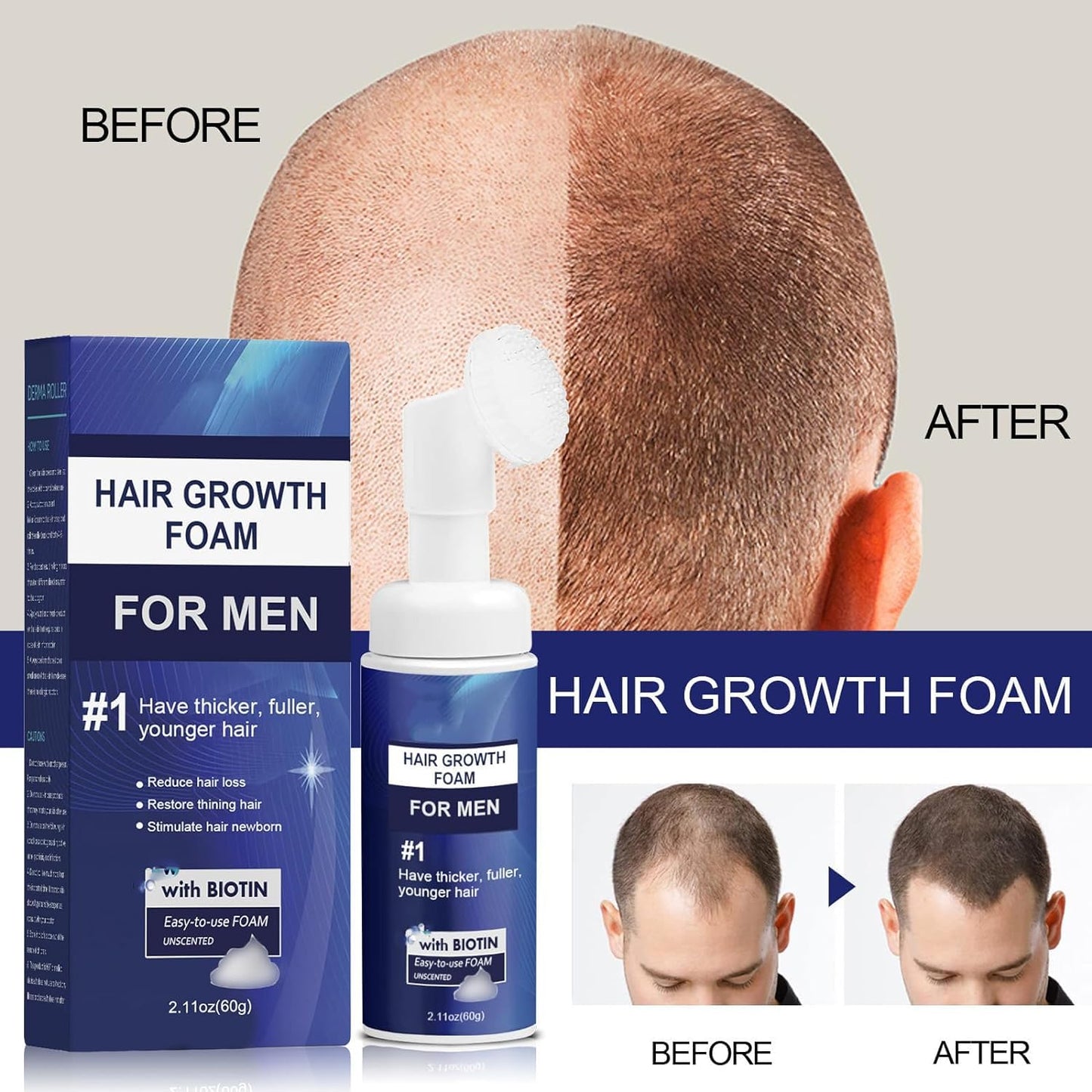 Renew Hair X Men, Renewhair-X, Renewhairx Men, Renew Hair X, Renewhairx, Renewhairx Hair Growth Foam, Renewhairx Hair Growth Foam for Men, Renewhairx Hair Growth (120g)