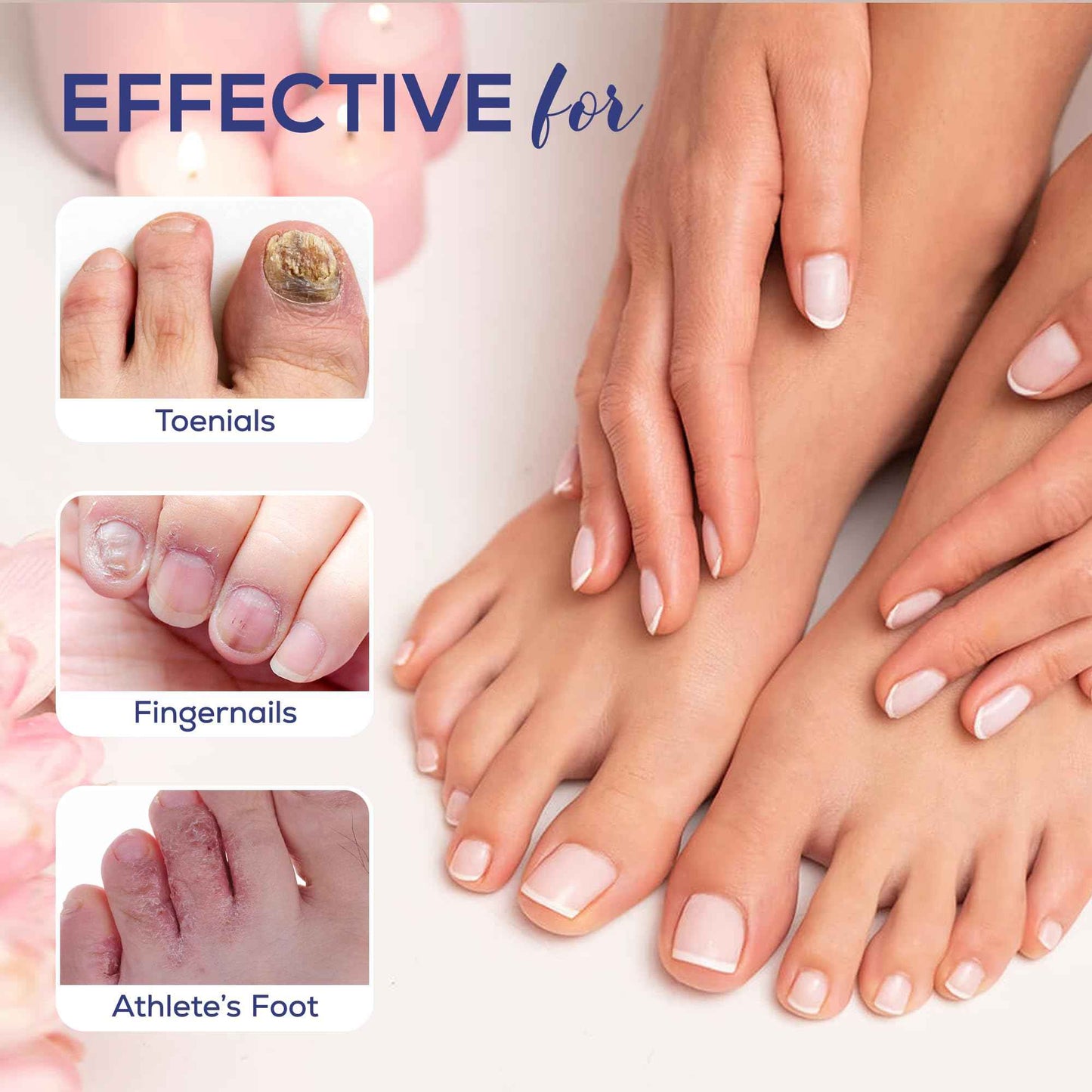 PHARMBANNER Toenail Fungus Treatment Extra Strength: 25% Undecylenic Acid Toe & Fingernail Fungus Renewal - Nail Fungus Treatment Kit with Brush & File - For Ingrown Nails & Discoloration