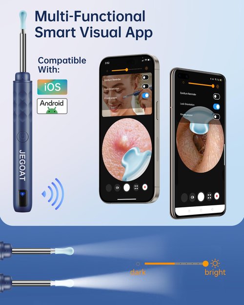 Ear Wax Removal Tool Camera, Ear Cleaner with Camera, Ear Cleaning Kit 1296P HD Ear Scope, 6 LED Lights and 12 Ear Picks, Earwax Removal with Otoscope to Earify Earwax for iOS and Android