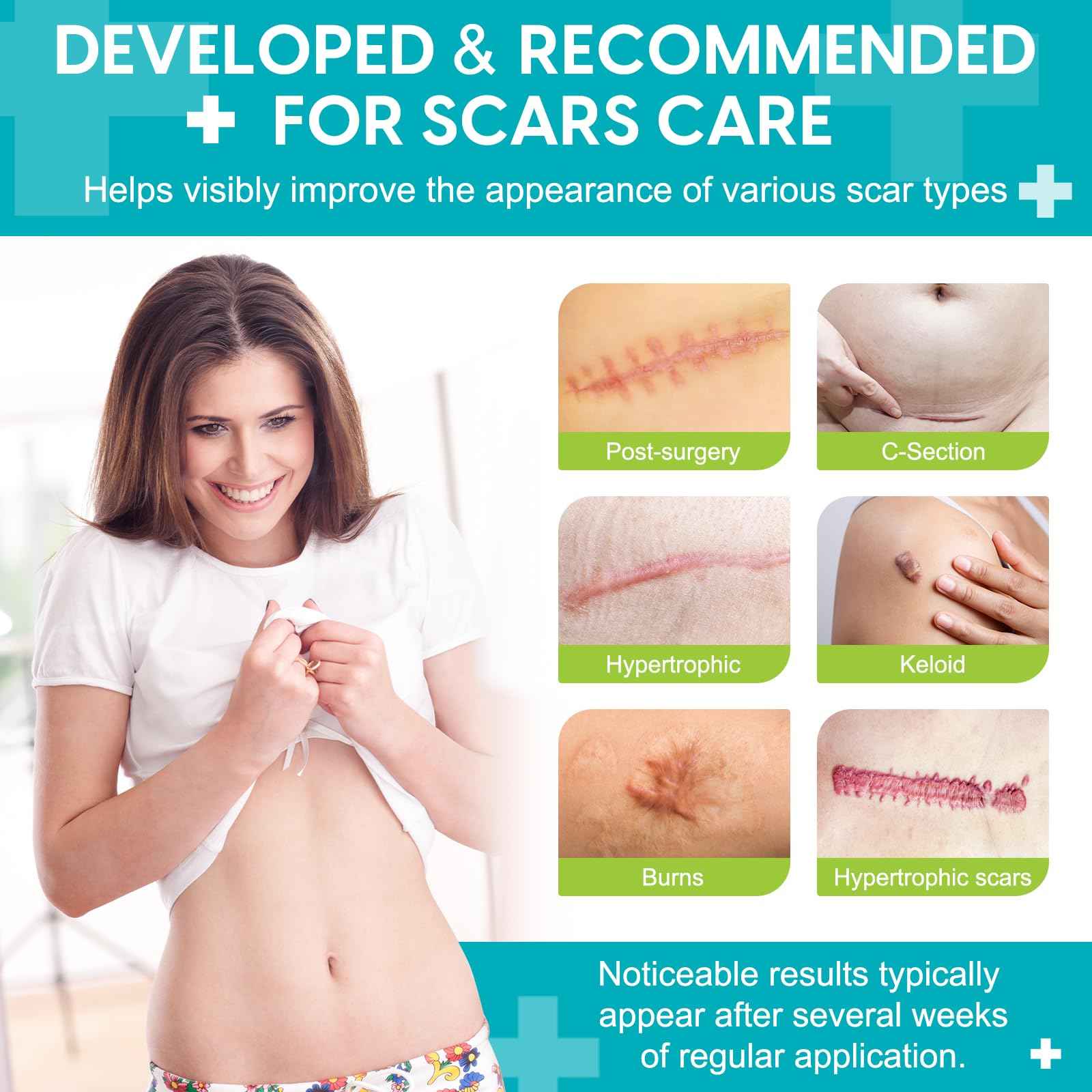 Silicone Scar Sheets (1.6” x 120”), Medical Grade Scar Tape for C-Section, Surgery, Keloid, Burn, Acne Scars - Reusable, Pain-Free, Safe for Sensitive Skin