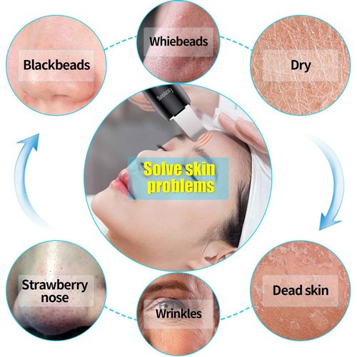 Facial Skin Cleanser with Mister, Upgraded Sprayer, Blackhead Extractor for Deep Cleansing and Moisturizing Spray