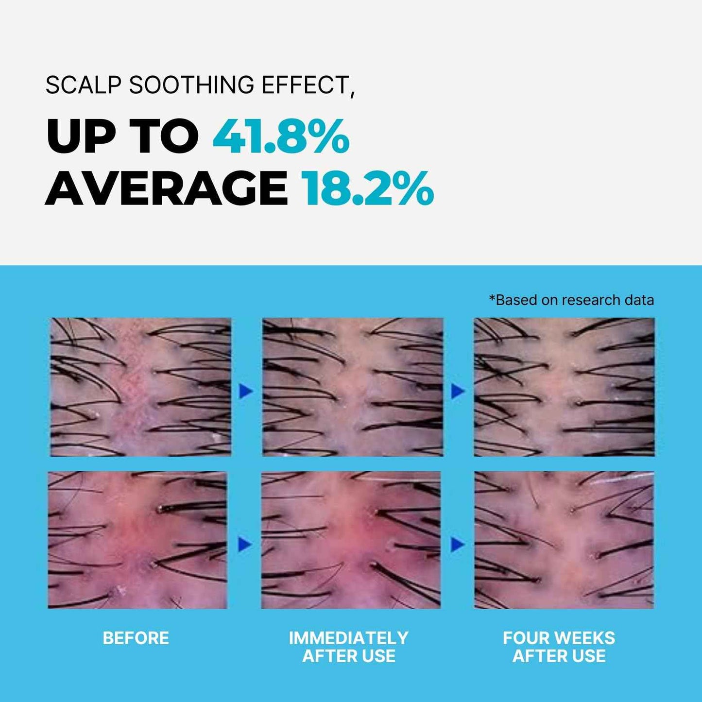 SWIM SALON Chlorine Removing Shampoo for Swimmers | Vitamin C | Clarifying & Hydrating | Free of Sulfates, Silicones, Parabens (10.58 oz / 300g, Pack of 2)