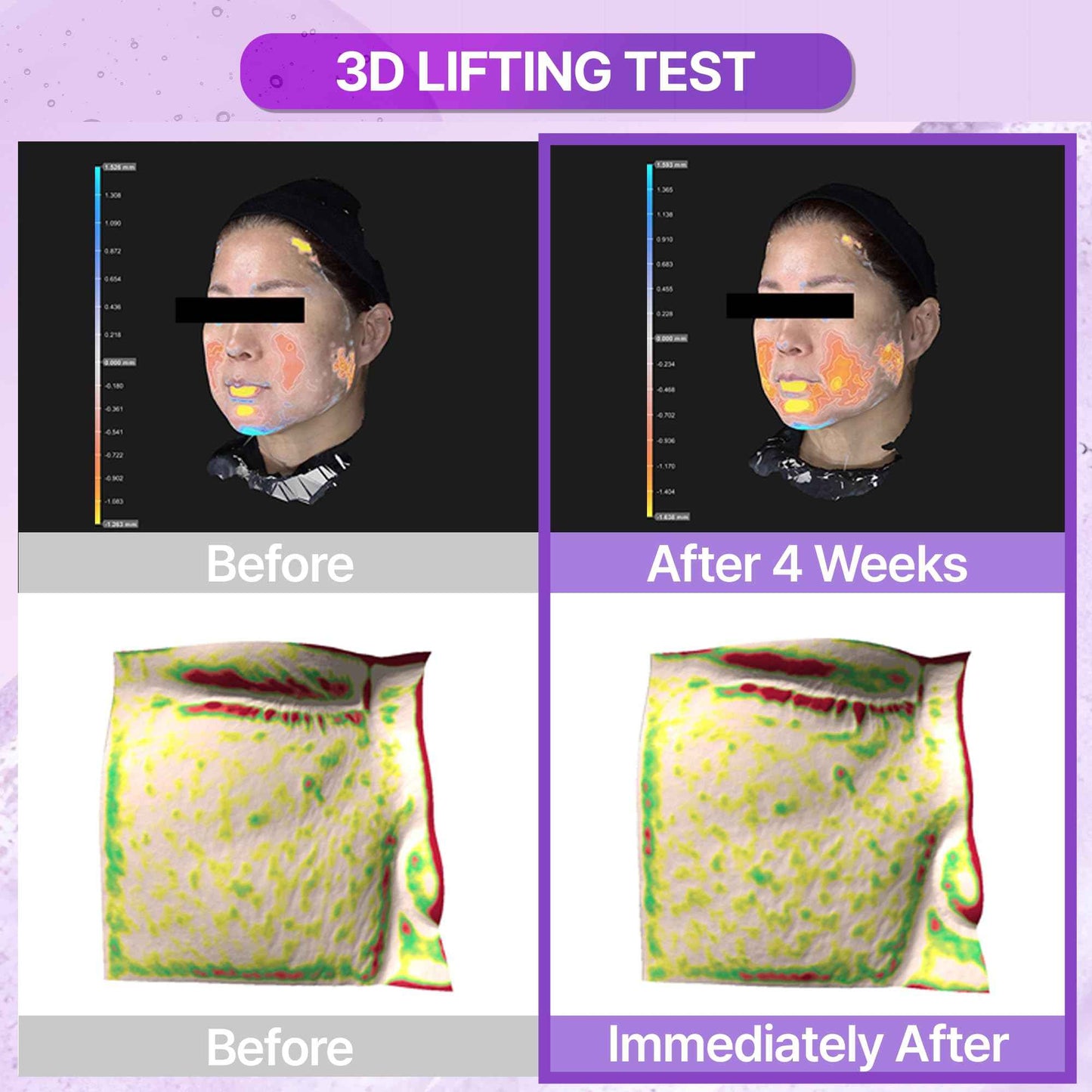 BIOHEAL BOH Probioderm 3D Lifting Essential Toner 5.07 fl oz (150 ml) | Hydrating & Lifting Face Toner with 17-Peptide Complex for Firmness & Elasticity