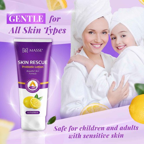 Candida Freedom Massey's Skin Rescue Probiotics Lotion - Daily lotion for Men & Women - Refreshing Lemon Scent - Non-Greasy Moisture for Smooth & Sensitive Skin - 3.4 oz