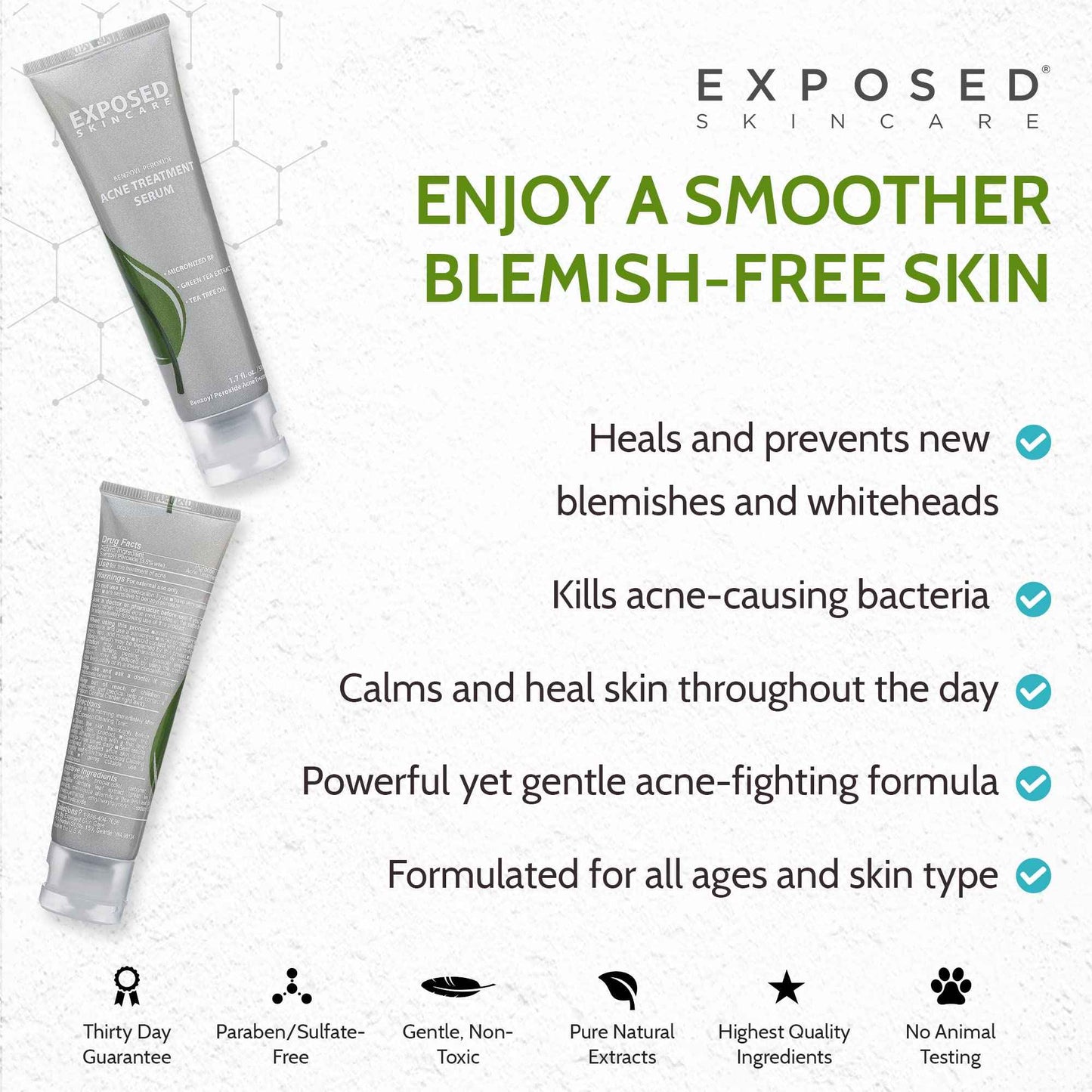 Exposed Skin Care, Acne Treatment Serum with 3.5% Benzoyl Peroxide – Lightweight Acne Spot Treatment – Quickly Clear Teen, Adult, Hormonal and Cystic Acne – Natural, Non-toxic and Cruelty Free