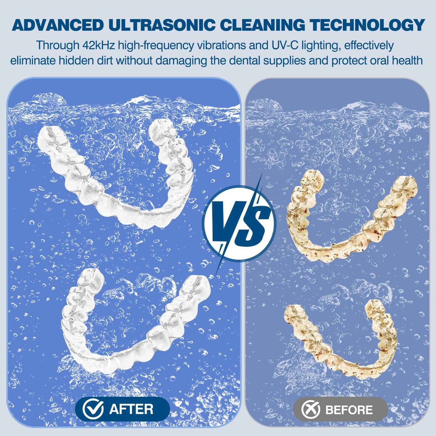 Dental Ultrasonic Retainer Cleaner Machine: 42KHz 28W 180ml,Dental Cleaning Pod for Dentures, Aligners & Mouthguards