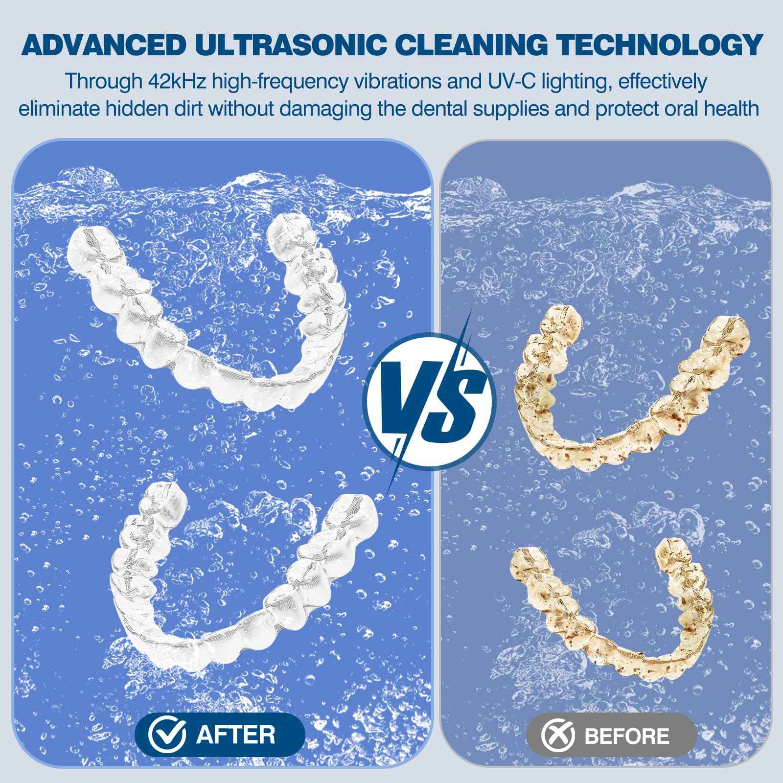 Dental Ultrasonic Retainer Cleaner Machine: 42KHz 28W 180ml,Dental Cleaning Pod for Dentures, Aligners & Mouthguards