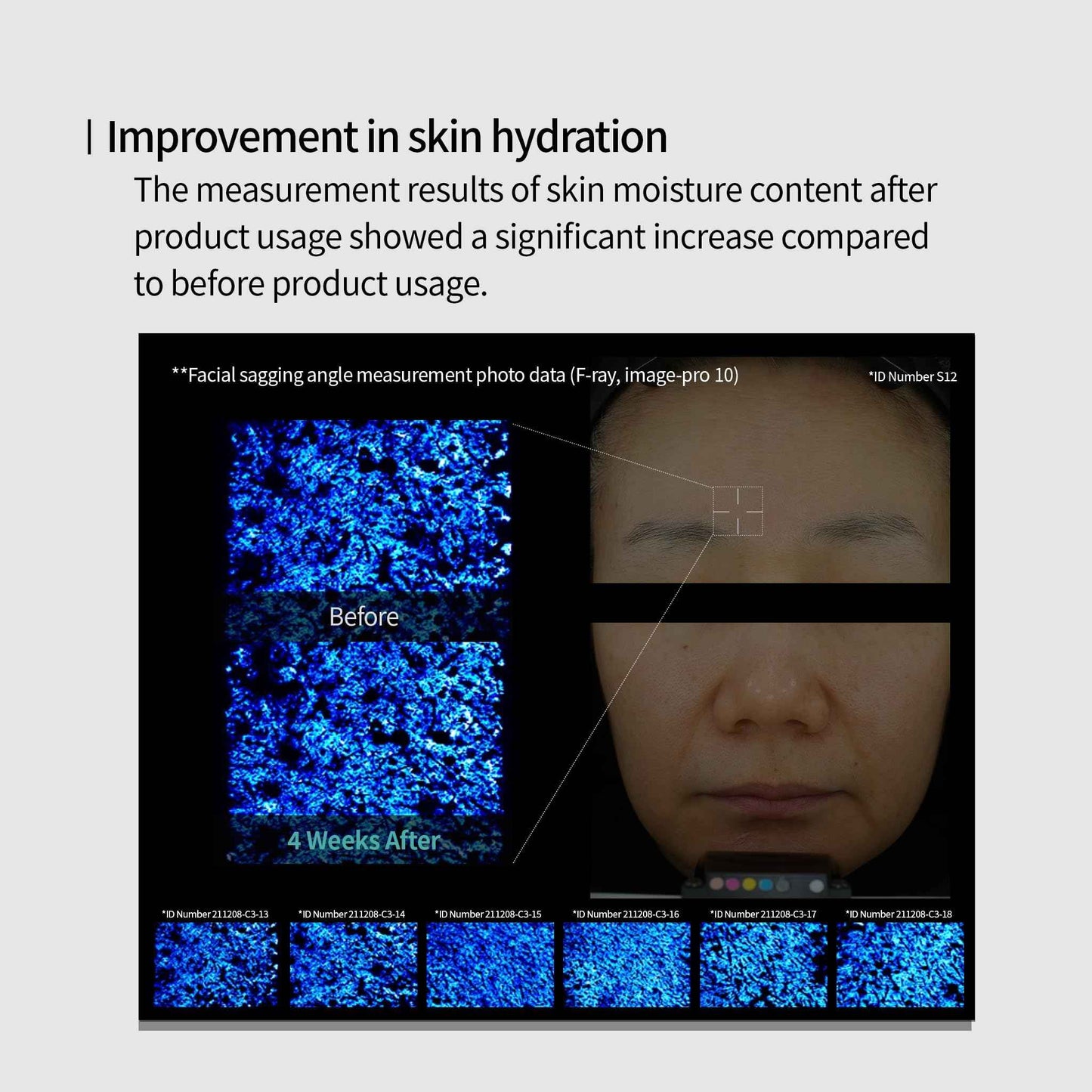 Genabelle Edelweiss Lifting Serum – Anti-Aging Formula with Edelweiss Extract, Niacinamide, Peptides for Firming, Hydration & Brightening – 1.35 fl.oz