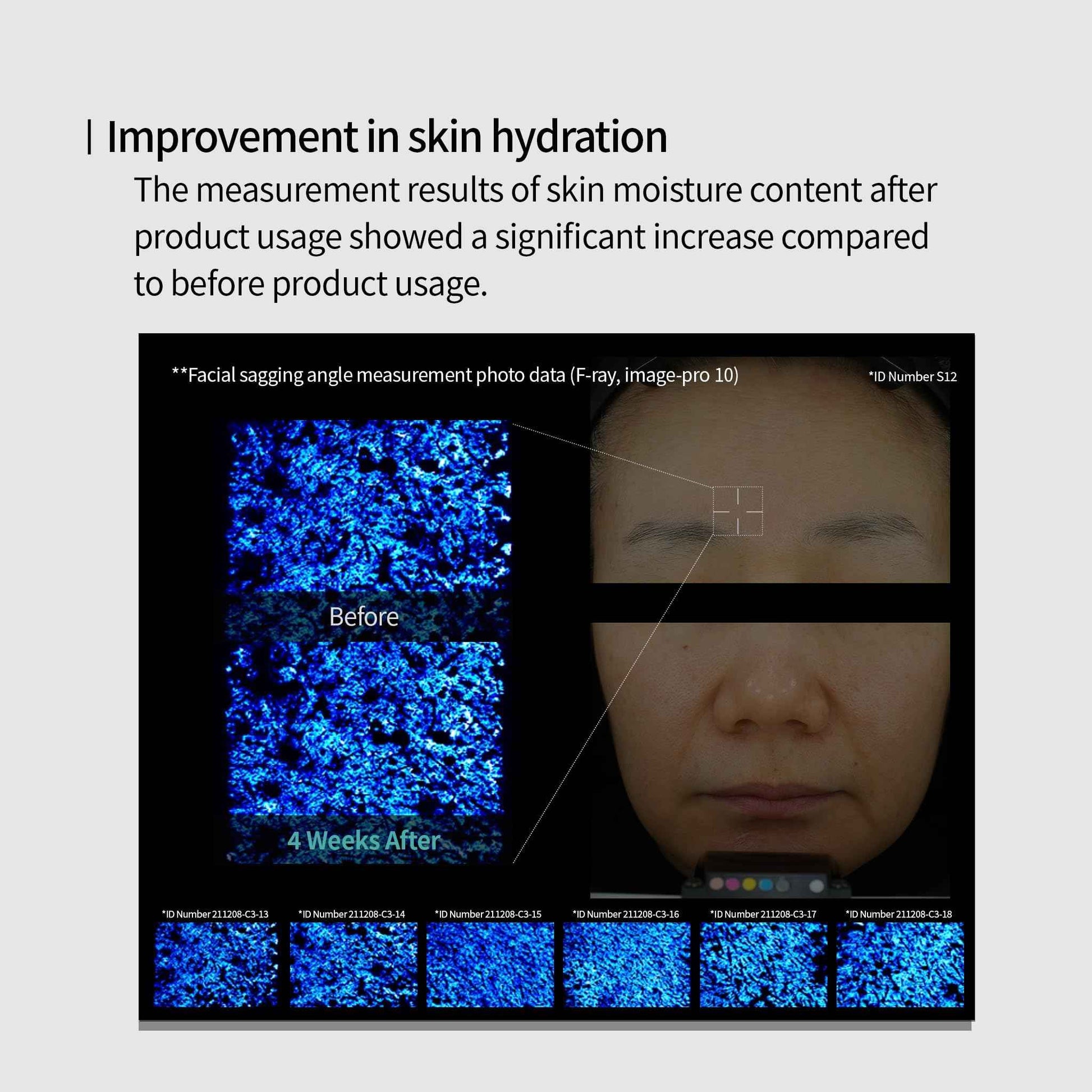 Genabelle Edelweiss Lifting Serum – Anti-Aging Formula with Edelweiss Extract, Niacinamide, Peptides for Firming, Hydration & Brightening – 1.35 fl.oz