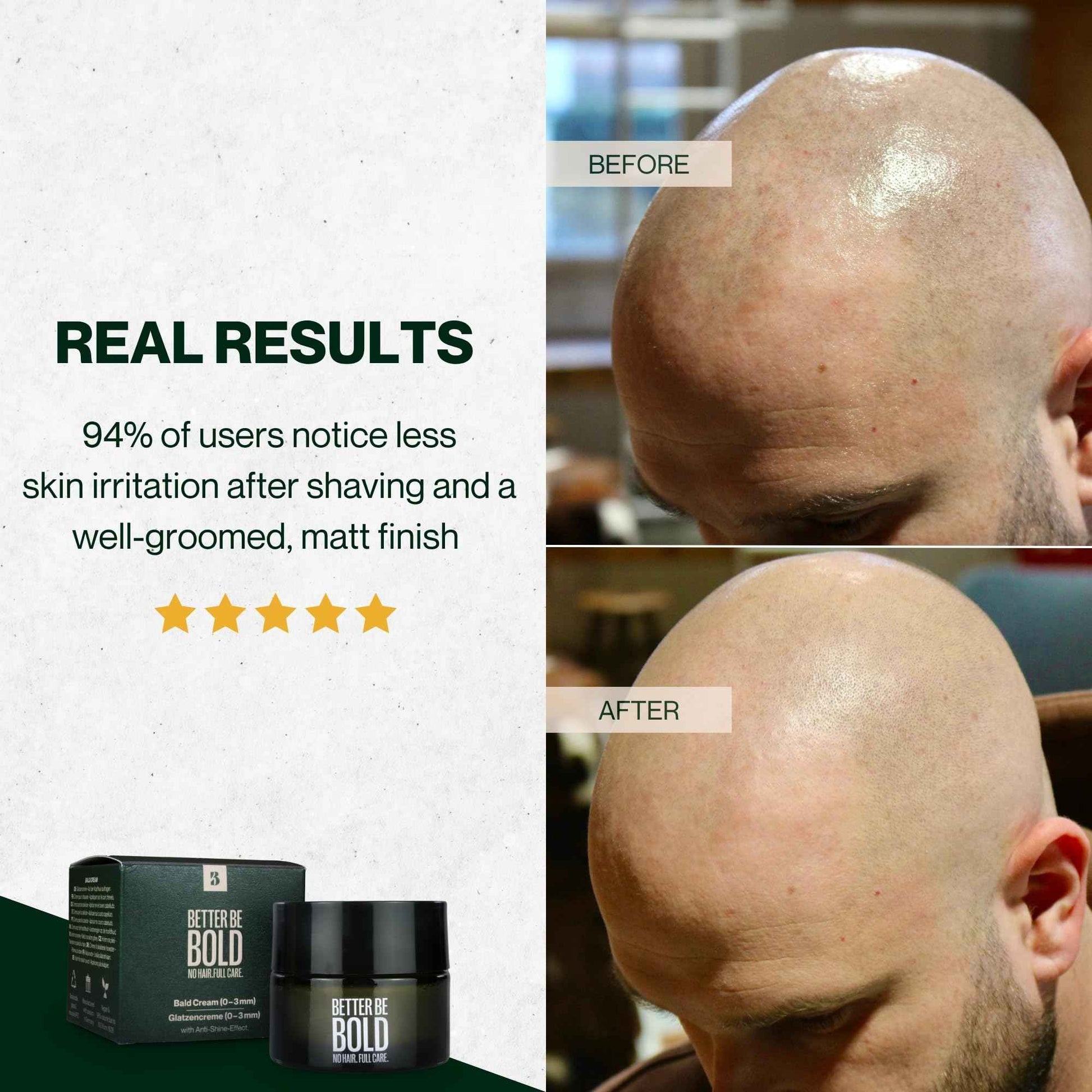 BETTER BE BOLD Nourishing bald cream (0-3 mm) with matte effect. Absorbs quickly. Fresh fragrance. Soothing skin after shaving thanks to magnolia extract. Natural and vegan. Made in Germany