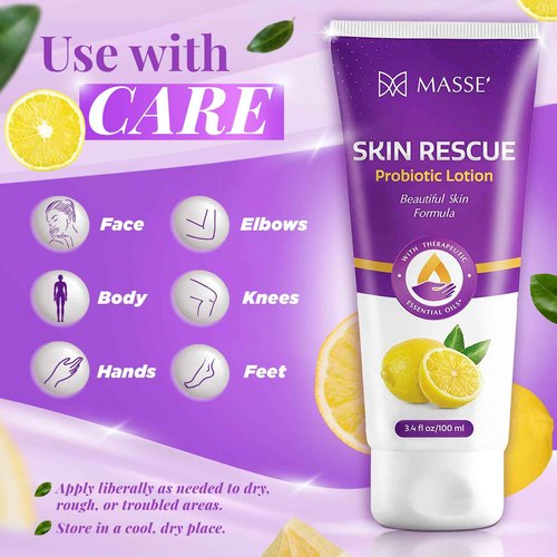 Candida Freedom Massey's Skin Rescue Probiotics Lotion - Daily lotion for Men & Women - Refreshing Lemon Scent - Non-Greasy Moisture for Smooth & Sensitive Skin - 3.4 oz