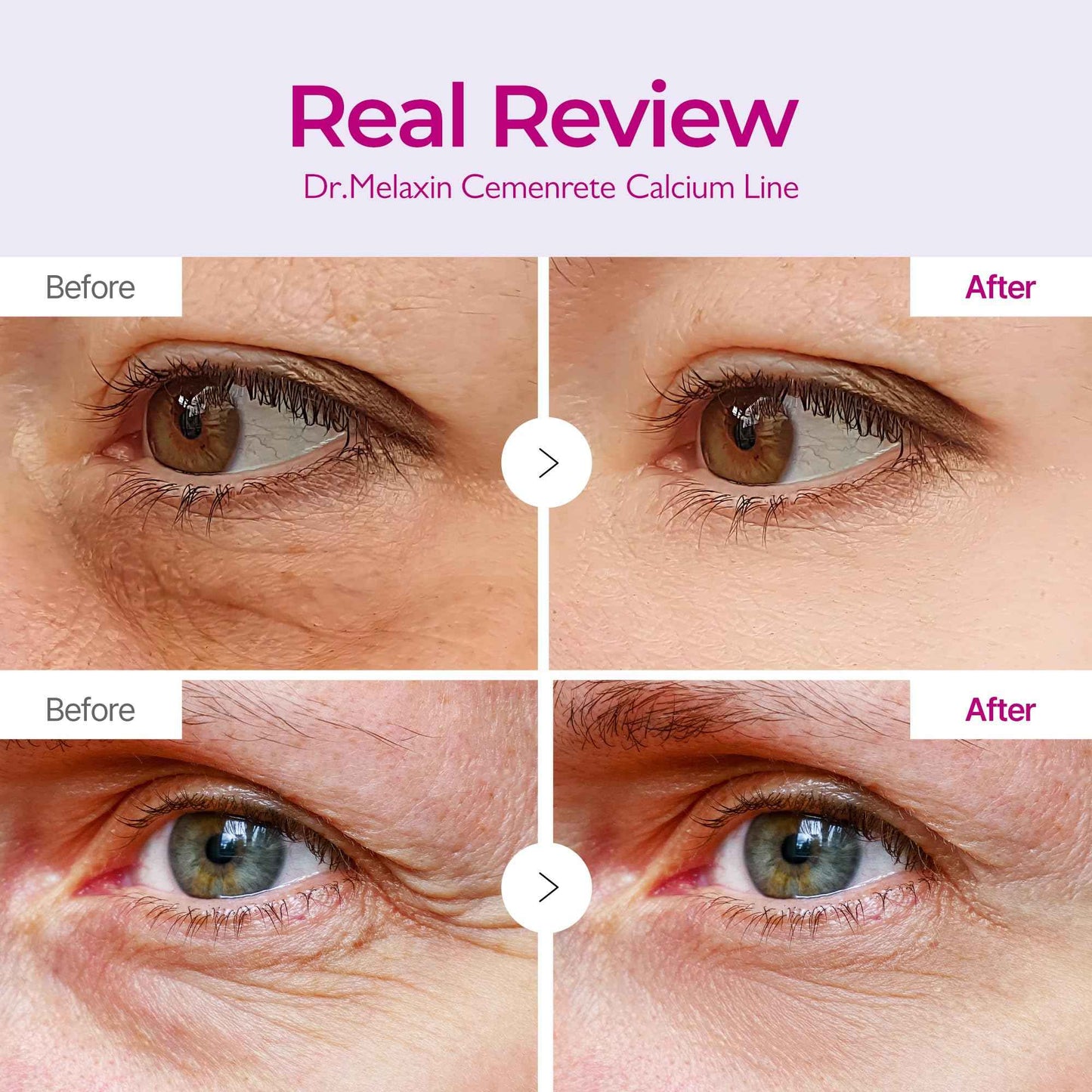 Dr.Melaxin Cemenrete Calcium Volume Eye patch 60ea