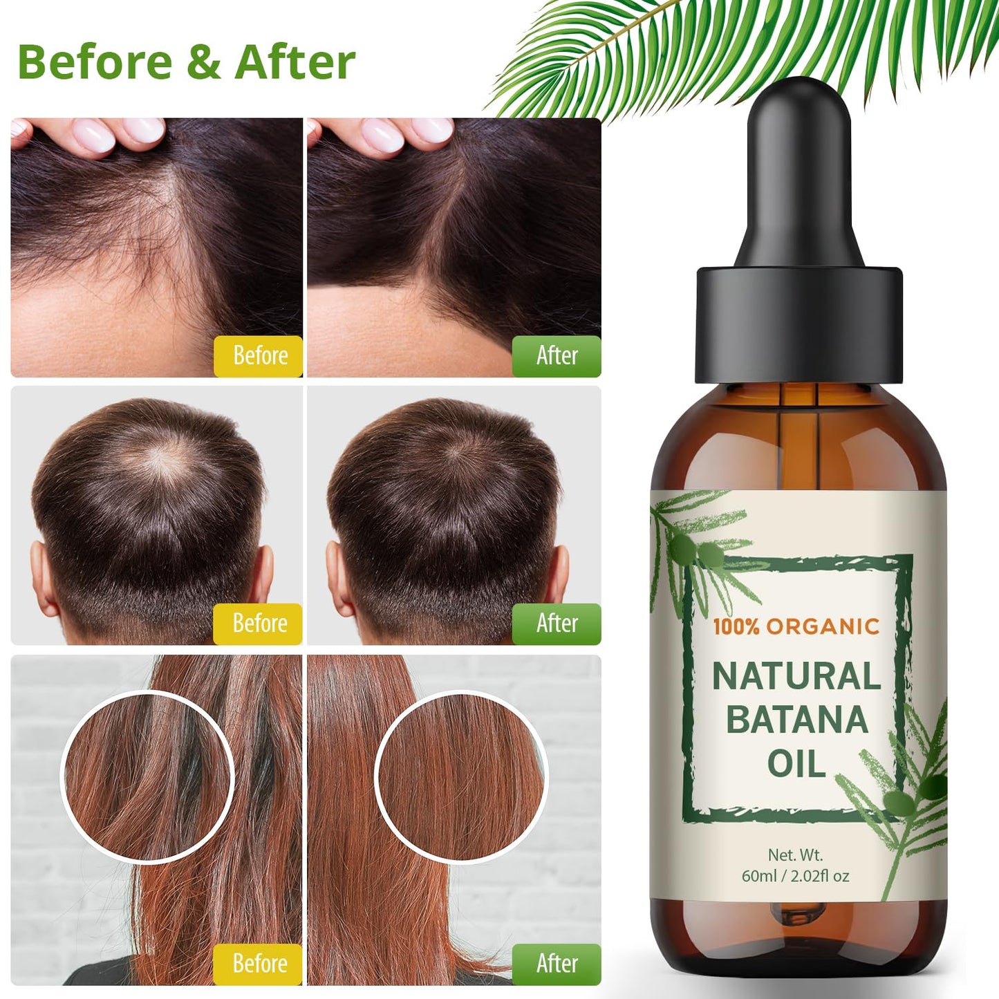 Raw Batana Oil for Hair Growth from Honduras, Dr. Sebi 100% Natural and Pure Nourishment to Prevent Hair Loss and Eliminate Split Ends in Men & Women