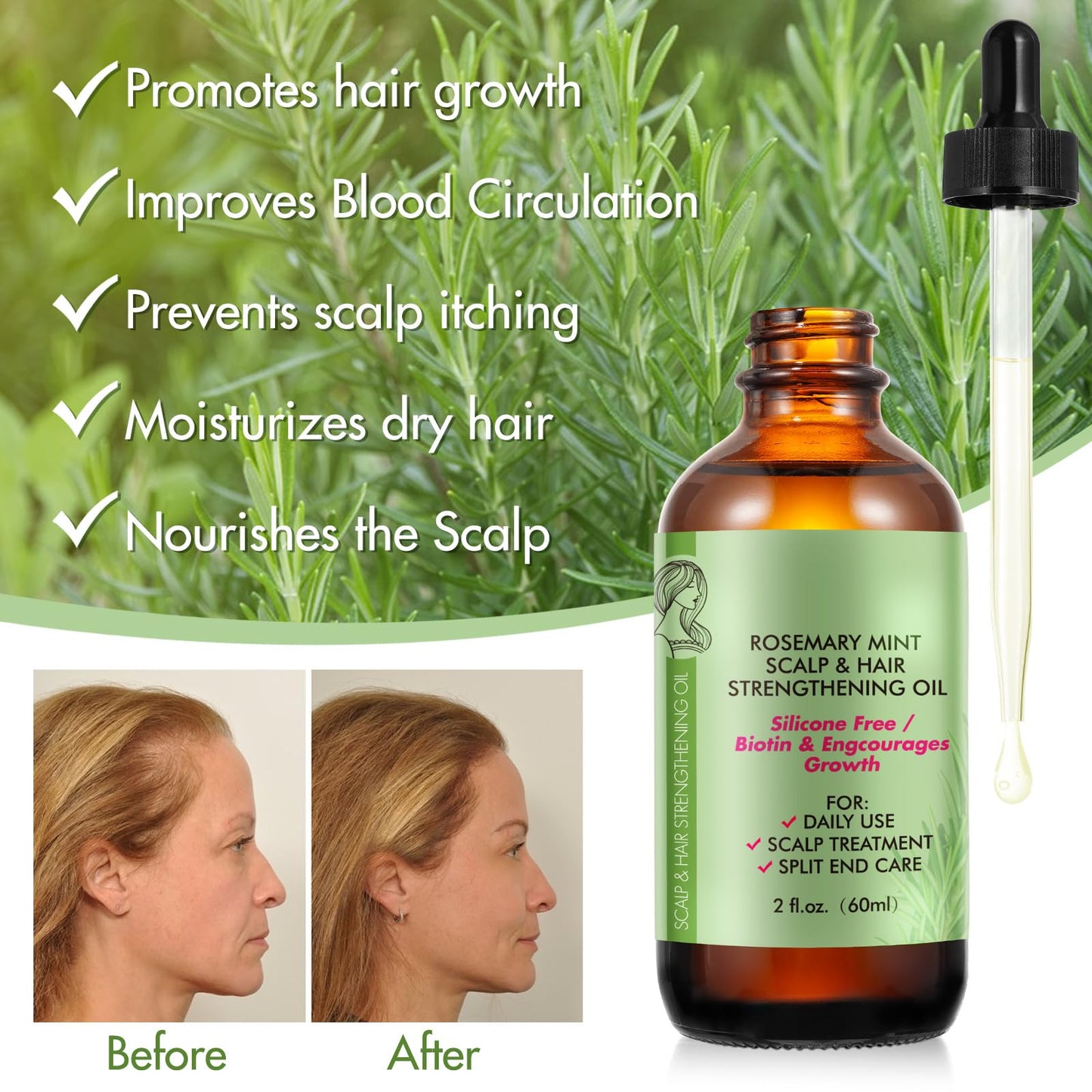 Rosemary Essential Oil (2 fl oz),Rosemary Oil for Hair Growth & Skin Care,Dry Scalp Treatment, Hair Growth Serum for Hair,Organic Hair Oil
