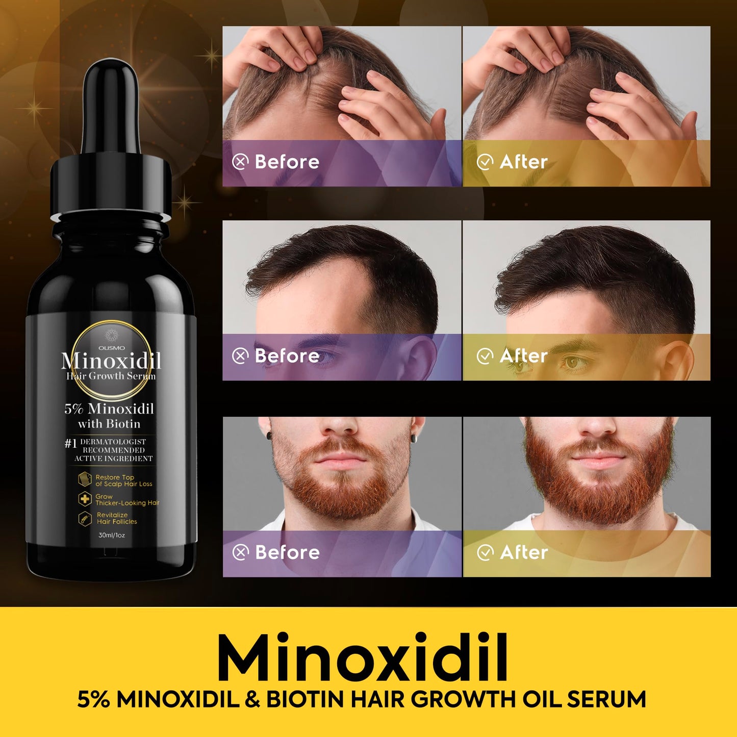 5% Minoxidil Hair Growth Serum, Minoxidil Hair Growth, Minoxidil for Women 5 Percent, Minoxidil for Men & Women Hair Growth, Hair Growth Oil for Women, Grow Gorgeous Hair Growth Serum 30ml