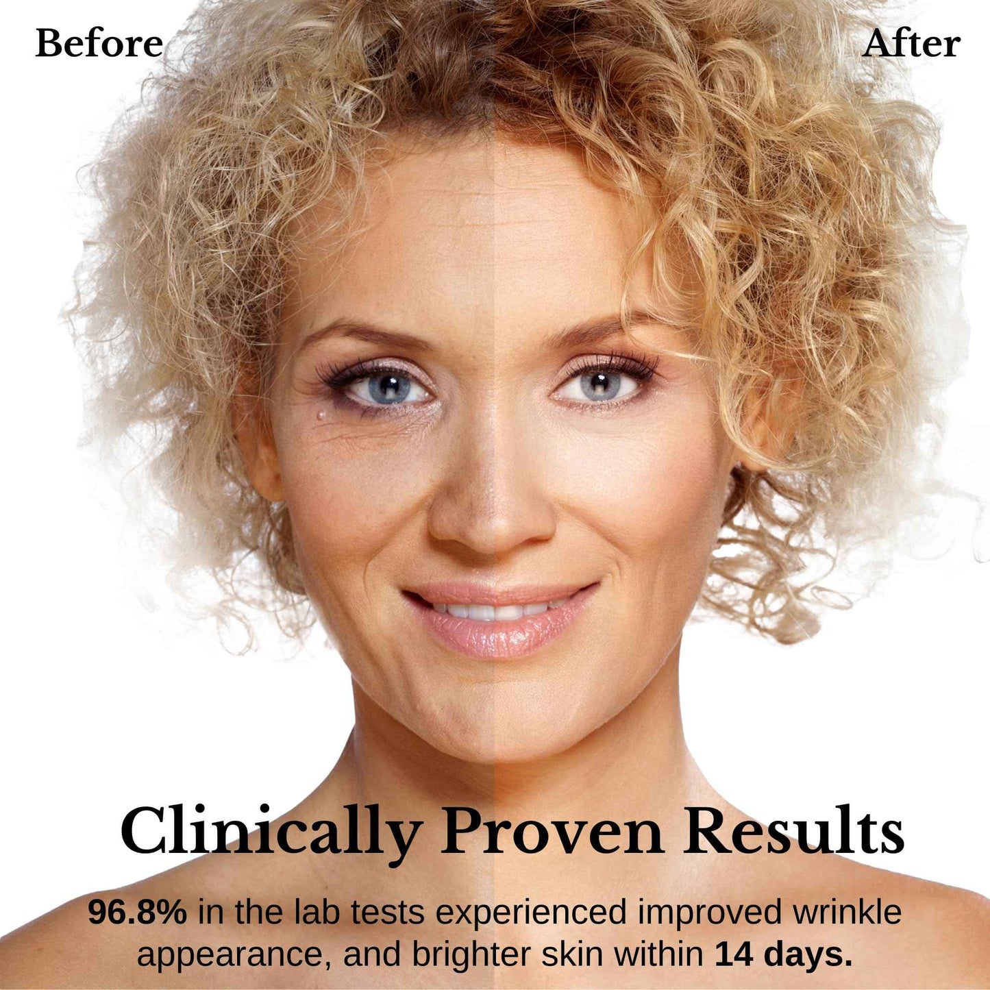 Lamelin Wrinkle Serum Cream, Retinol & Bakuchiol & Niacinamide, 10 Vitamins & Herbs, Antioxidant, Eye Bag Dark Neck Correction, Day & Night Skin Brightening, 1.76 Fl Oz. Made in Korea