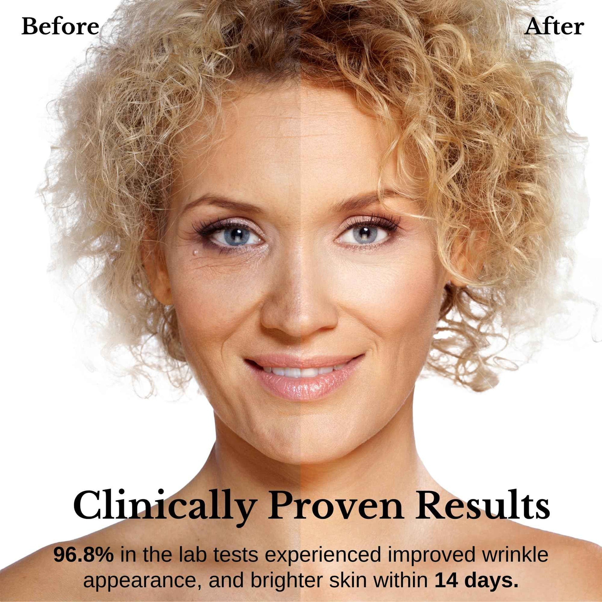 Lamelin Wrinkle Serum Cream, Retinol & Bakuchiol & Niacinamide, 10 Vitamins & Herbs, Antioxidant, Eye Bag Dark Neck Correction, Day & Night Skin Brightening, 1.76 Fl Oz. Made in Korea