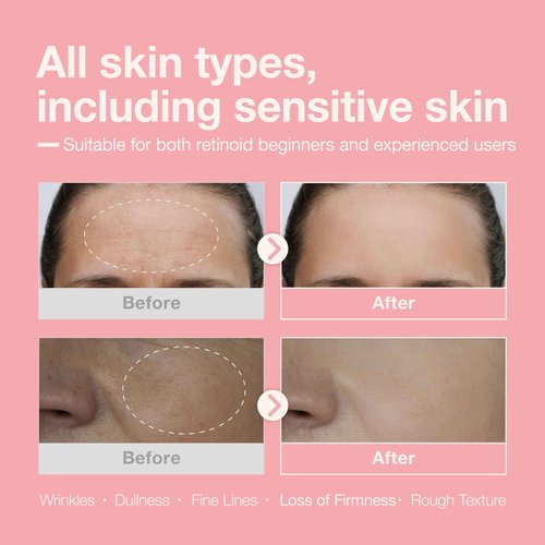 Cosyuree Retinol + Retinal + Peptide Booster Serum – 1,000ppm Retinol, 100 ppm Retinal, Anti-Aging Face Serum with Peptides, Hyaluronic Acid, Niacinamide & Collagen, Fragrance-Free, 30ml (1.01 fl oz)