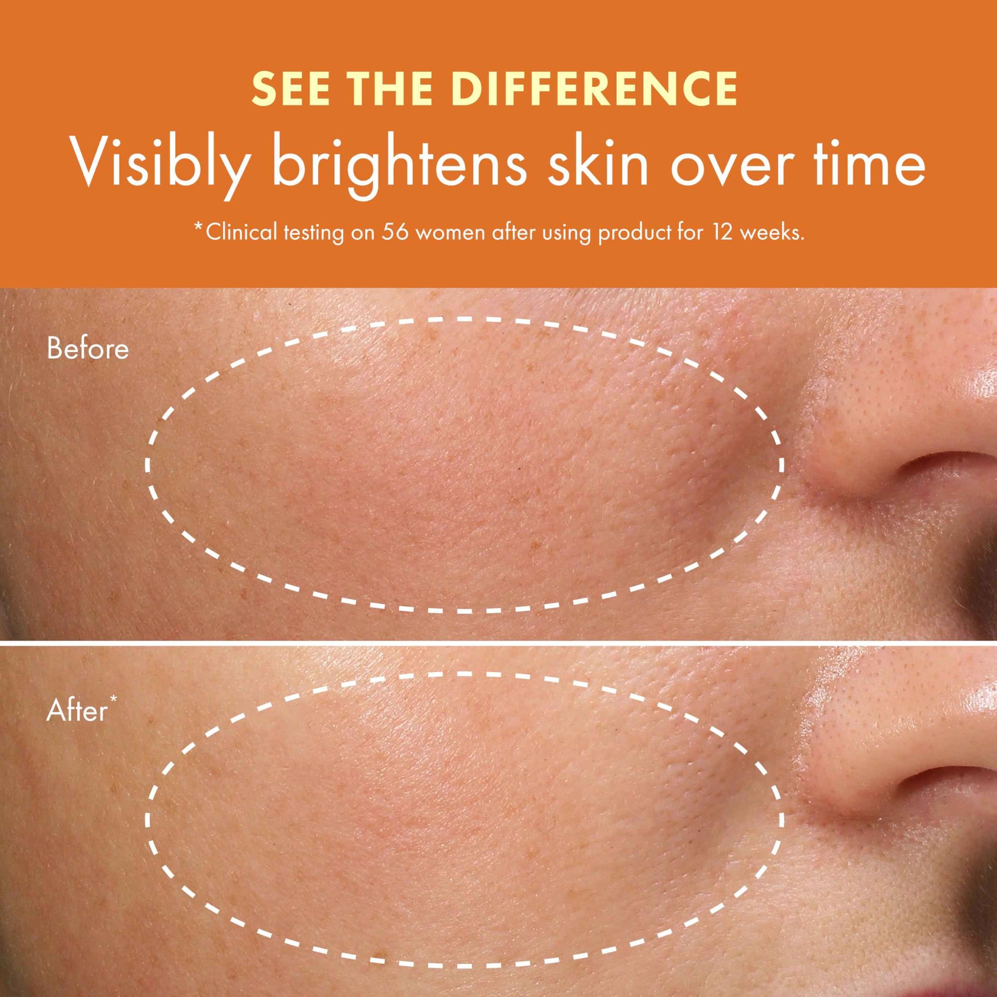 Origins GinZing Energizing Gel Cream | Face Moisturizer for Radiance and Glow | With Vitamin C, Niacinamide, Ginseng, and Caffeine | Travel Size, 1 Fl Oz