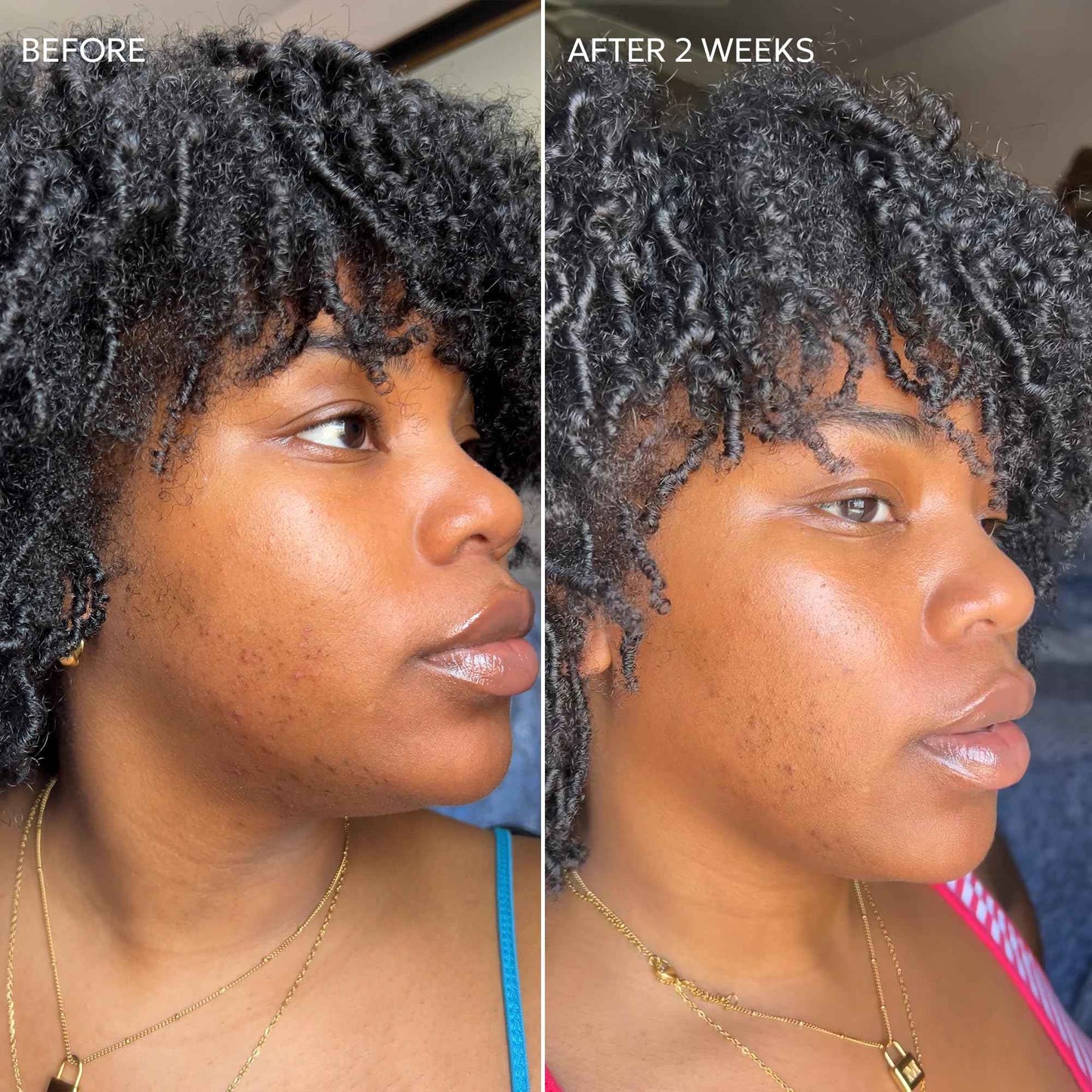 Dermisa Skin Fade Cream with Antioxidant Vitamin C | Helps Reduce Appearance of Dark Spots, Freckles, Marks from Acne, Aging, and Use of Birth Control | Light Non-Greasy & Quick Absorbing Cream | 1.78 OZ | Pack of 3