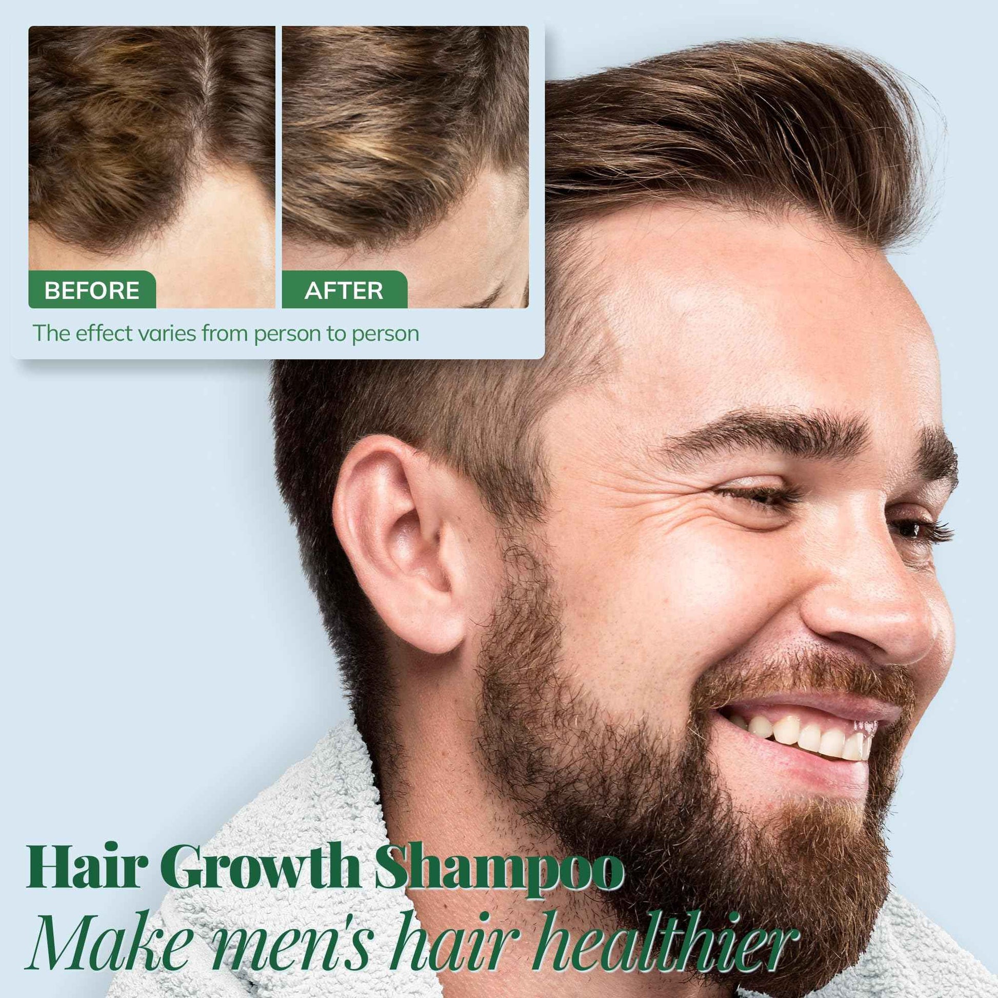 Hair Growth Shampoo, Rosemary, Caffeine, Biotin, Oil Control, Scalp Care, Hair Loss Shampoo for Strengthen Roots, Hair Thickening, Men, Women