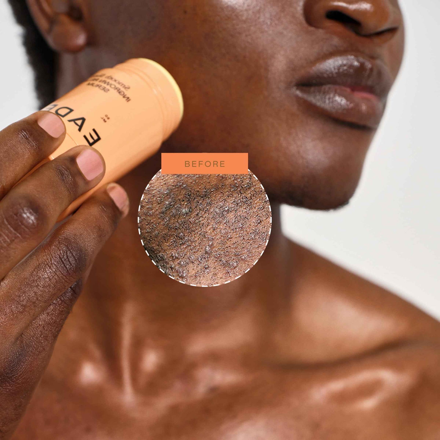 EADEM Smooth Slate Ingrown Hair Roller Serum, Targets Bumps Trapped Hairs, Faded Topicals for Scarring and Dark Spots, AHAs and Tyrosinase, Slows Ingrown Hair Regrowth