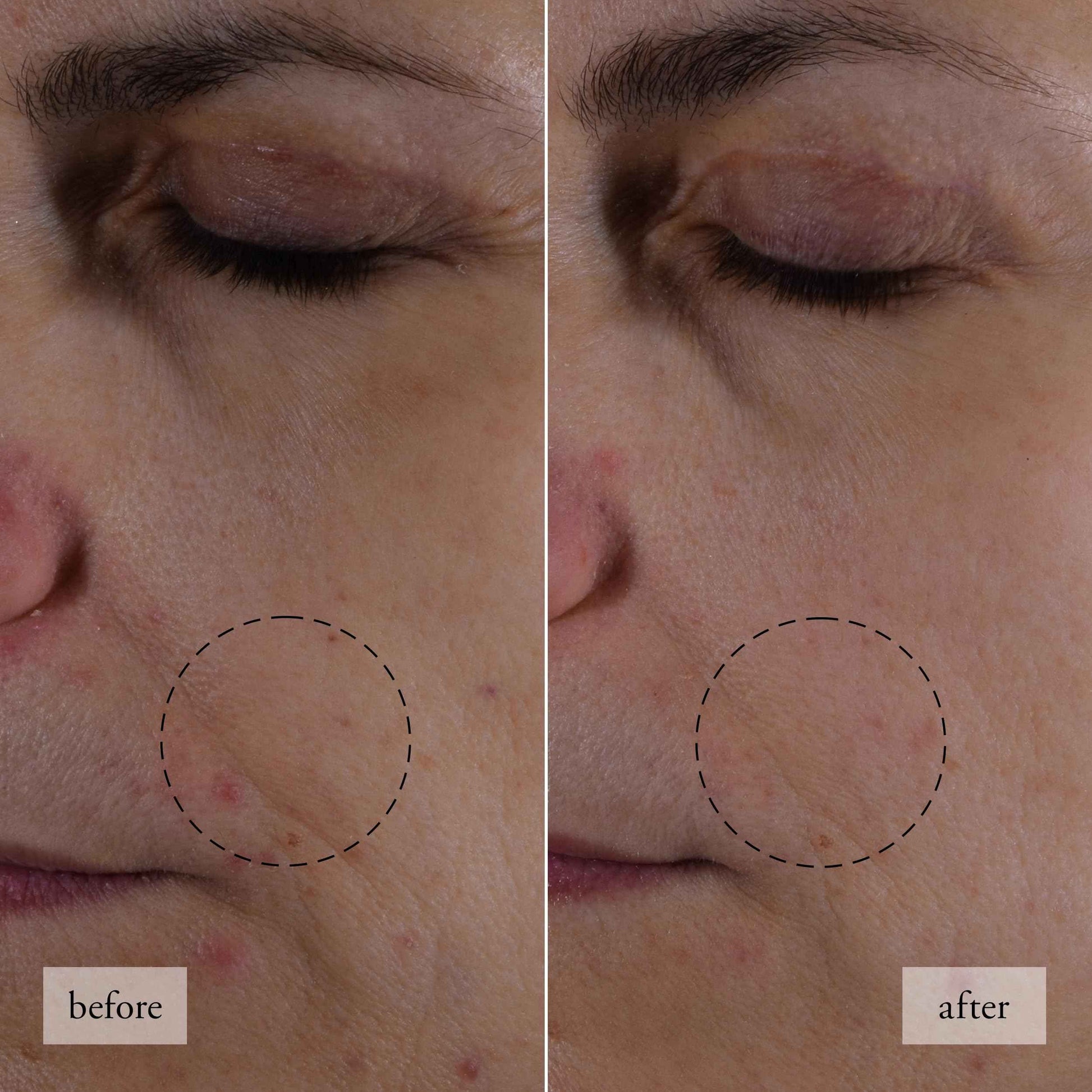 philosophy hope in a jar skincare essentials mini set