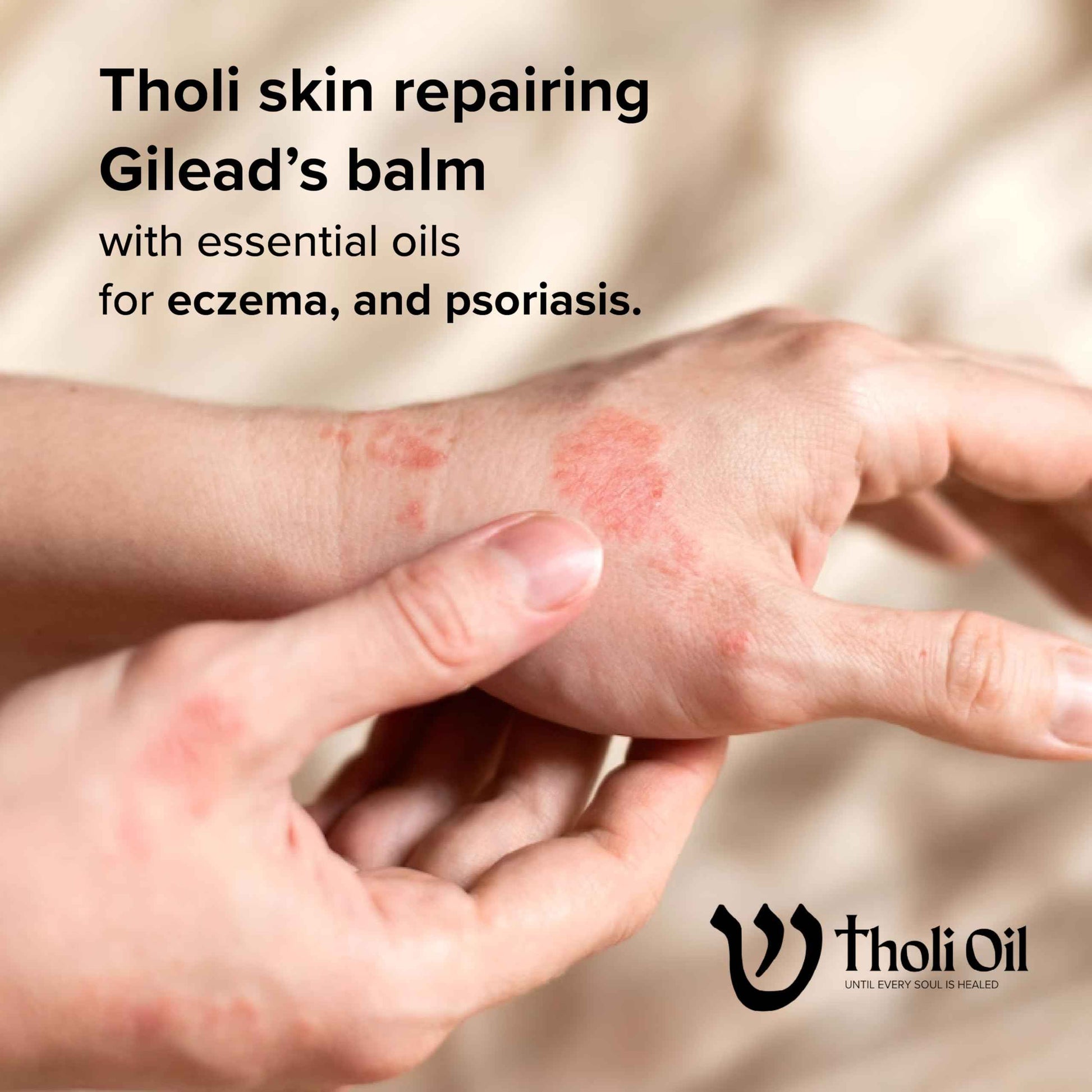 Tholi Oil Balm of Gilead Skin Repair Salve – Fast-Acting Natural Formula Soothes, Restores & Protects Dry, Damaged Skin – With Poplar Buds, Beeswax, Cocoa Butter