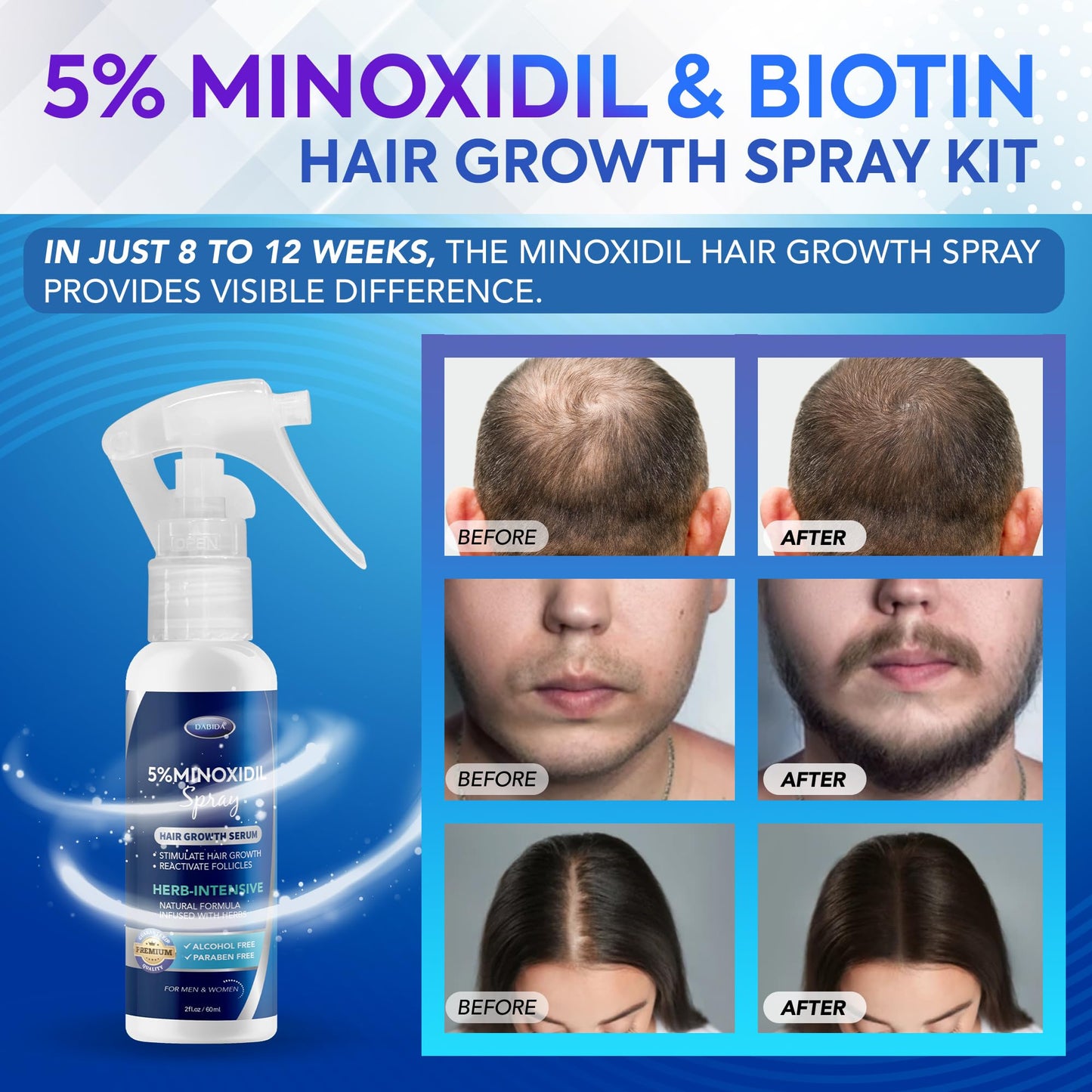 Minoxidil for Women 5 Percent, Minoxidil Spray, Minoxidil for Men, Minoxidil for Women Hair Growth, Minoxidil 5 Percent Women, Minoxidil Women 60ml