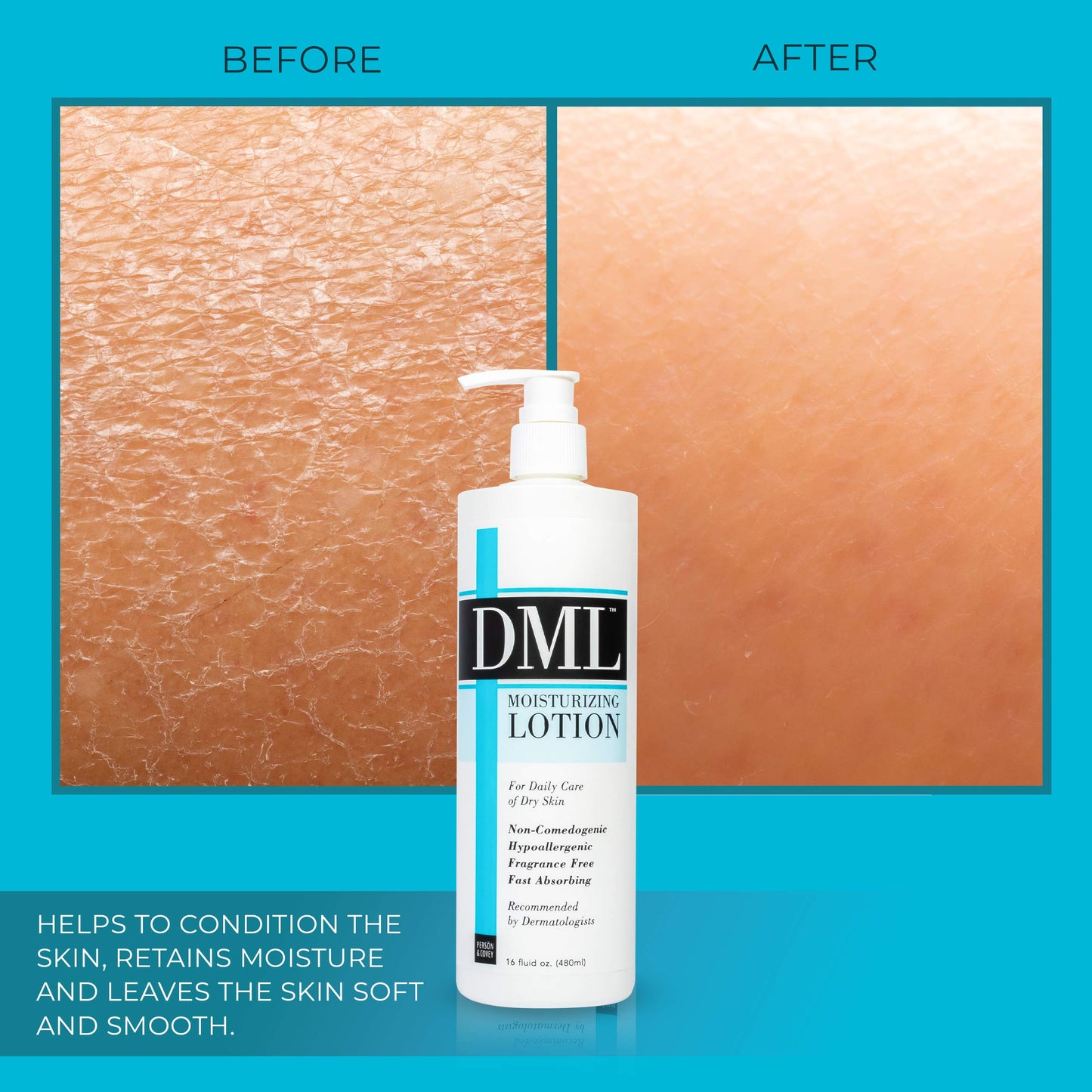 DML Moisturizing Lotion, 16 Fl Oz