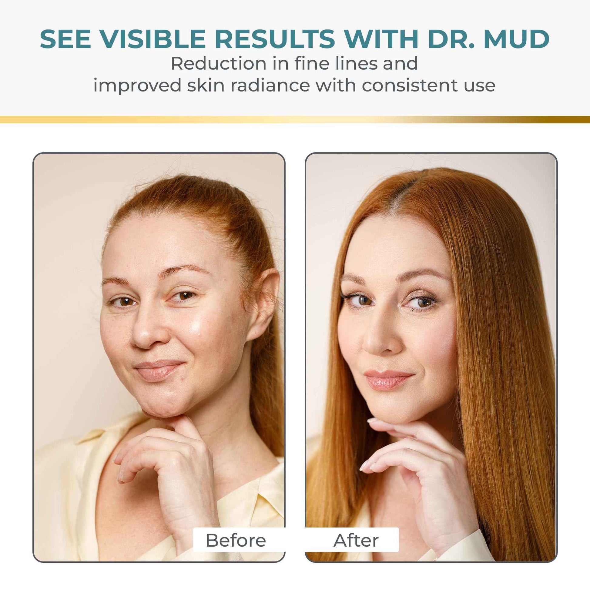 Dr Mud Anti aging Brightening Serum for Wrinkles, Dark Spots, Eye Area & Fine Lines - with Dead Sea Minerals, Hyaluronic Acid, Aloe Vera, Vitamin E & Vitamin A, Caster, Jojoba & Sesame Oil - 50 ml