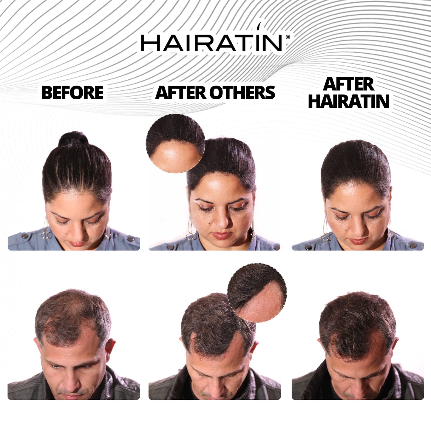 HAIRATIN Building Fibers for Thinning Hair, Black, 28G - Achieve Fuller, Natural Looking Results, Instantly Conceals Hair Loss in 10 Seconds, Thickener & Bald Spot Cover Up for Men & Women