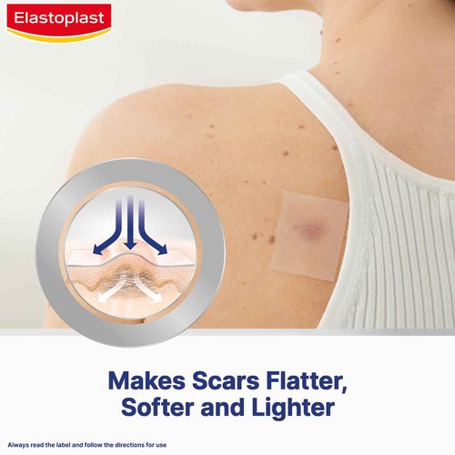 Elastoplast Scar Reducer Plasters (21 Pieces), Quick and Convenient Scar Cover Up Treatment, Scar Sheets to Reduce Visbility of Scars, Scar Plaster Pack for Quick Results