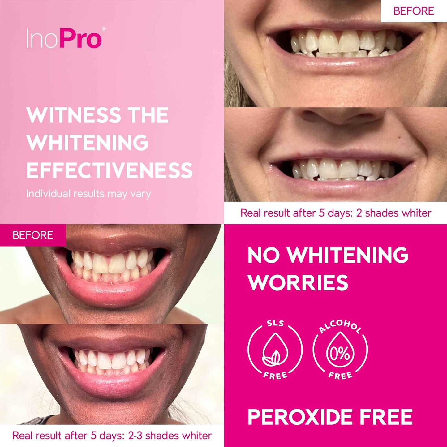 InoPro Teeth Whitening Strips 14 Treatments Kit - Enamel Safe Teeth Whitener, Peroxide-Free, Green White Strips for Teeth Whitening with Arbutin, Coconut Oil, Deep Stains Removal (28 Strips)
