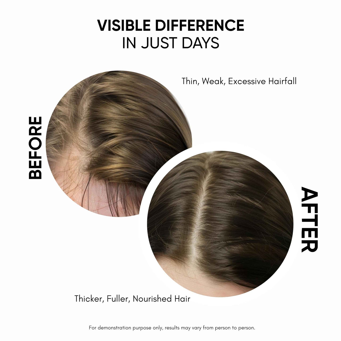 Masofta Hair Growth Serum For Promoting Hair Growth & Controlling Hair Fall With 3% Redensyl, 5% Capixyl, 4% Anagain, 3% Procapil & Rosemary & Biotin, For Both Men & Women, 50 ml (Pack of 1) White