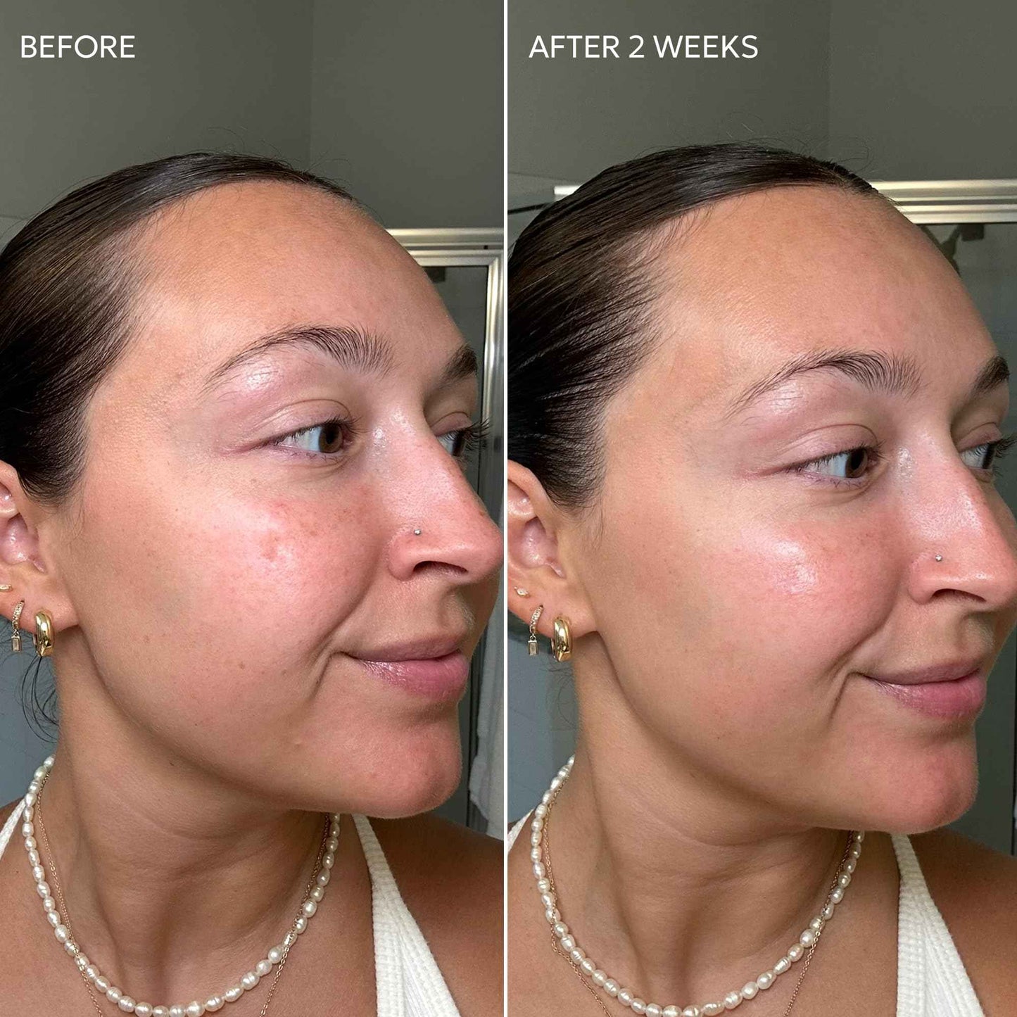 Dermisa Skin Fade Cream with Antioxidant Vitamin C | Helps Reduce Appearance of Dark Spots, Freckles, Marks from Acne, Aging, and Use of Birth Control | Light Non-Greasy & Quick Absorbing Cream | 1.78 OZ | Pack of 3